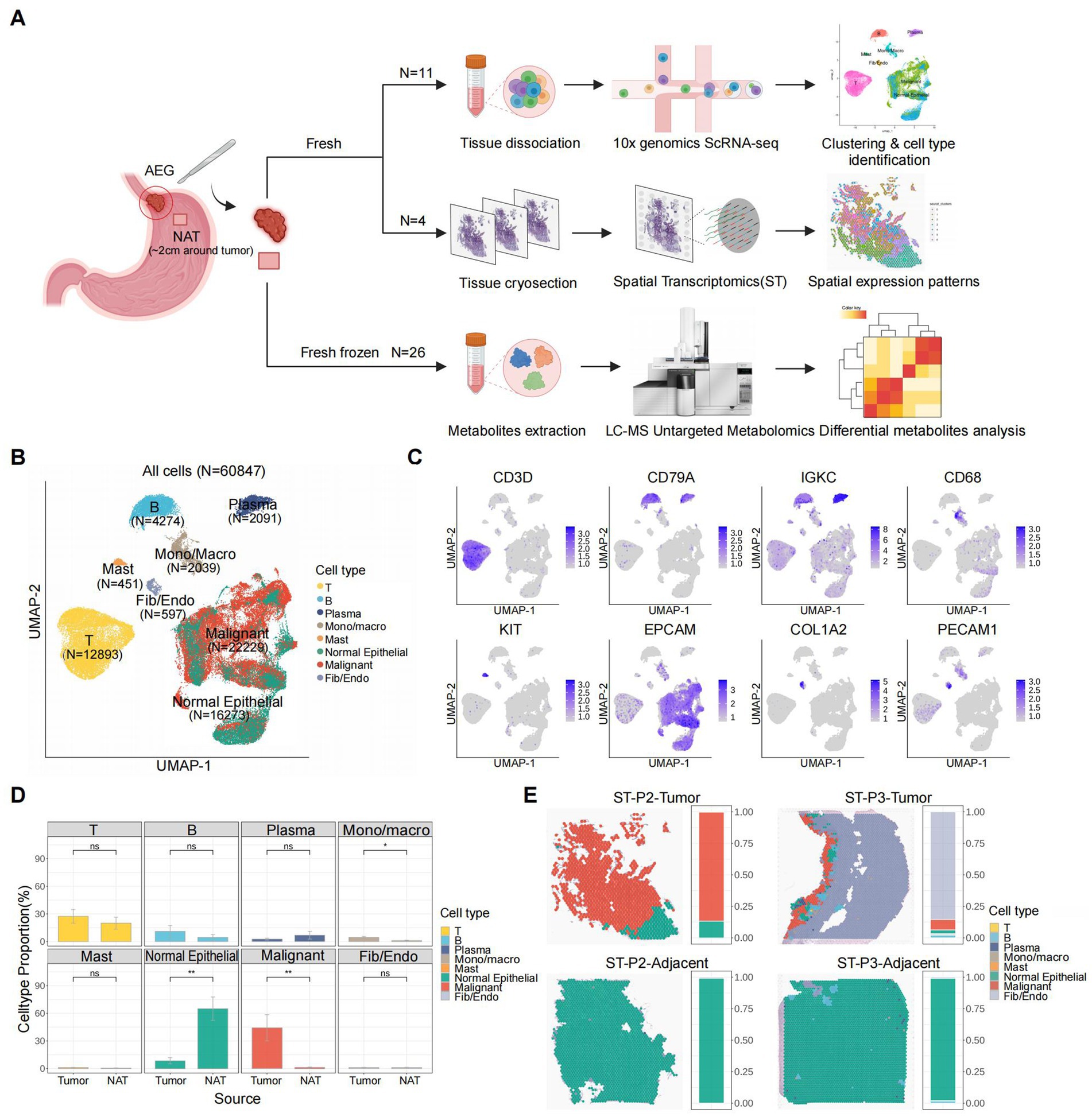 Diagram illustrating a multi-step analysis of tissue samples. Panel A shows the workflow for tissue dissociation, cryosection, and metabolite extraction using technologies like scRNA-seq and LC-MS. Panel B presents a UMAP plot depicting cell type clustering. Panel C showcases expression patterns for various genes. Panel D features bar charts comparing cell type proportions in tumor versus normal adjacent tissues. Panel E includes spatial transcriptomics maps indicating cell type distribution in tumor and adjacent sections.