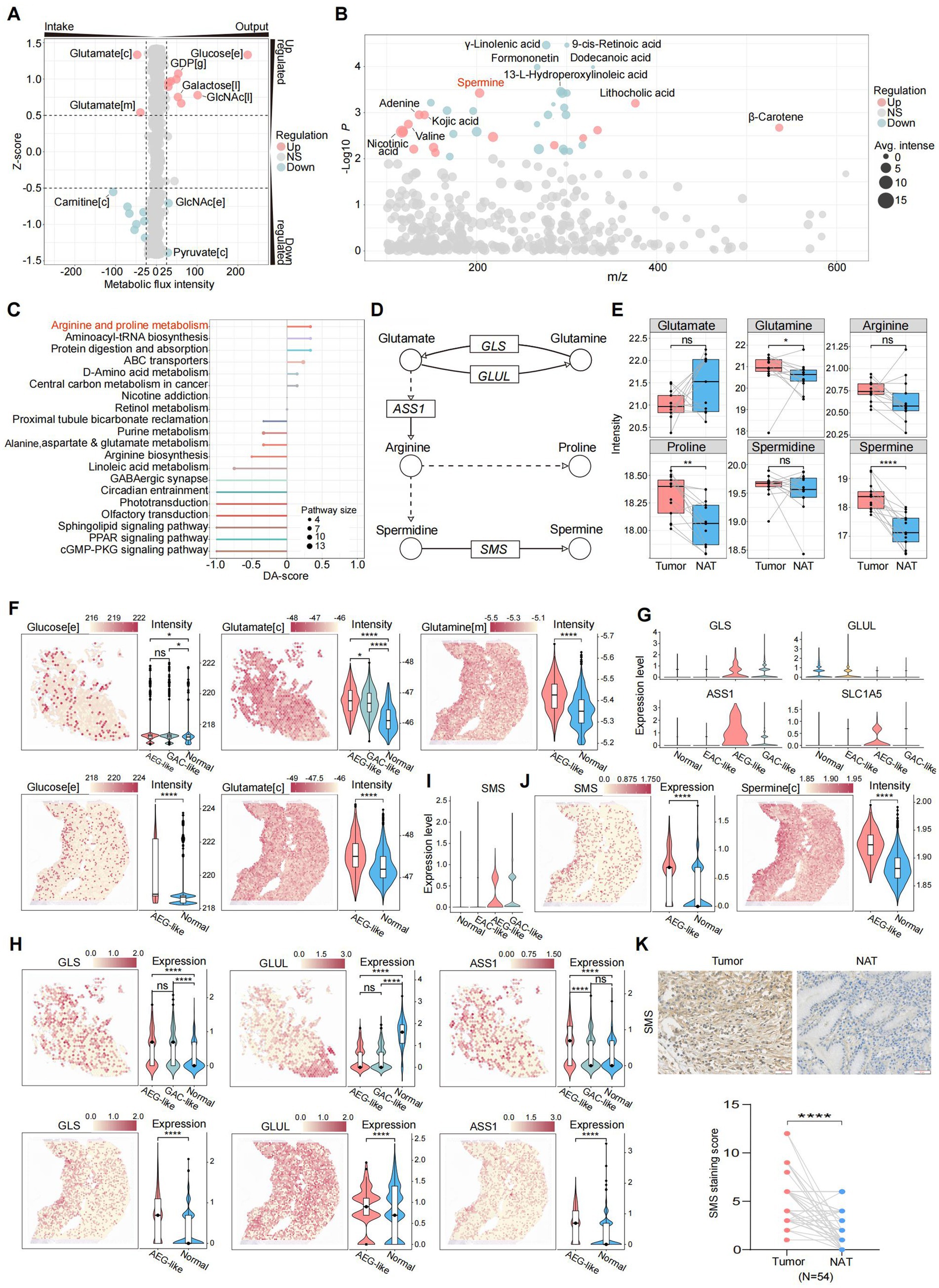 A collection of scientific charts and diagrams analyzing metabolic and gene expression data related to tumors and normal adjacent tissues (NAT). Panel A shows metabolic flux data with a Z-score chart. Panel B presents a volcano plot of metabolites. Panel C details pathway analysis with a bar graph. Panel D illustrates metabolic pathways involving GLS, GLUL, ASS1, and SMS enzymes. Panel E provides box plots of metabolite intensities in tumors versus NAT. Panels F to J feature color-coded tissue images, violin plots, and intensity graphs for metabolites like glucose and glutamate across different conditions. Panel K includes tissue staining images and a comparison graph of SMS staining scores.