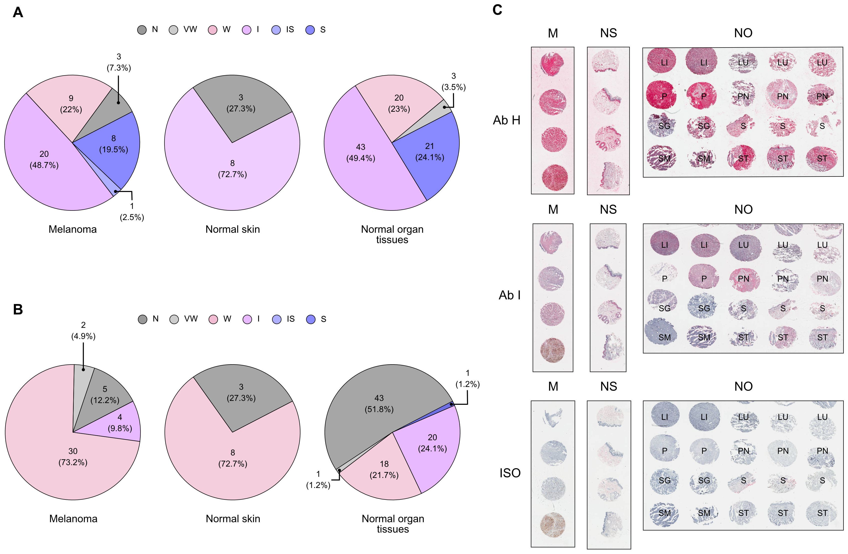 Panels show three sets of data. Panel A and B feature pie charts comparing the distribution of tissue conditions (N, VW, W, I, IS, S) in melanoma, normal skin, and normal organ tissues. Panel C displays stained tissue samples labeled M (melanoma), NS (normal skin), and NO (normal organ tissues) for antibodies Ab H, Ab I, and ISO, showing varying stain intensities across tissue types.