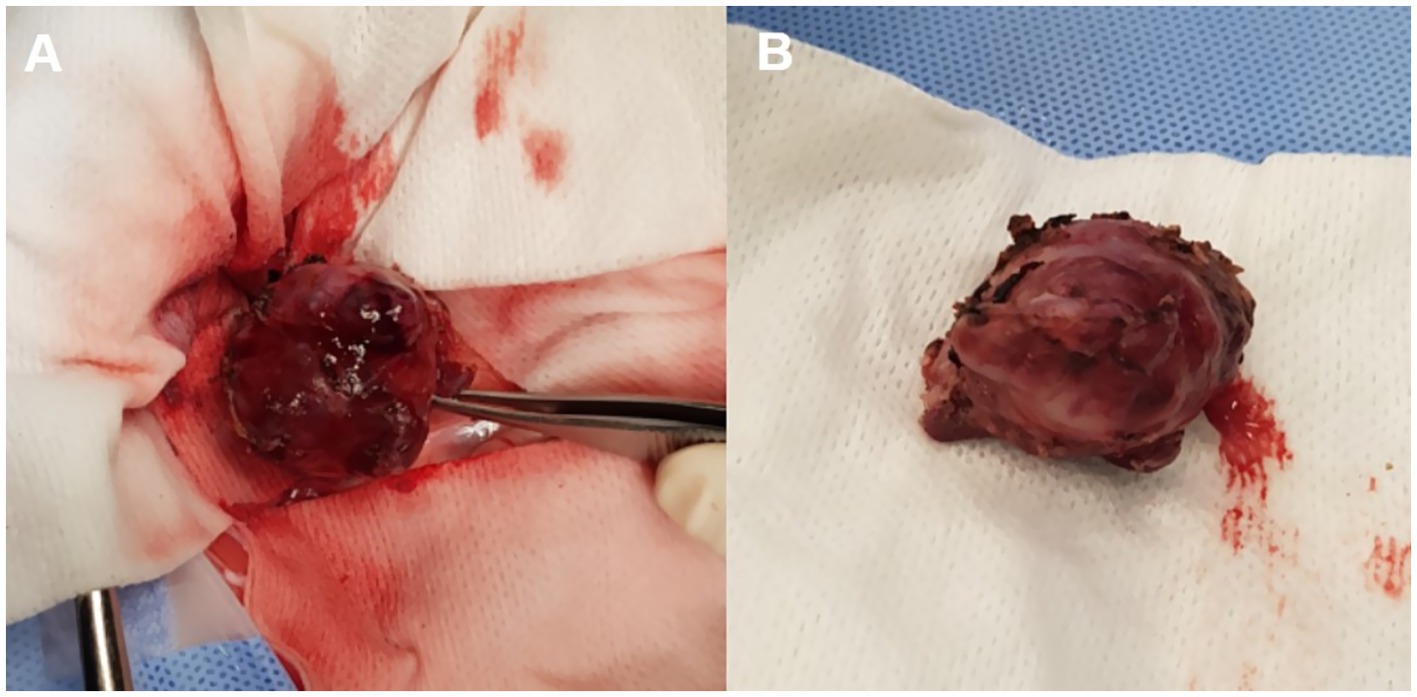 Image A shows a surgical specimen being held with forceps against a blood-stained cloth, while Image B displays the same specimen on a clean cloth background.