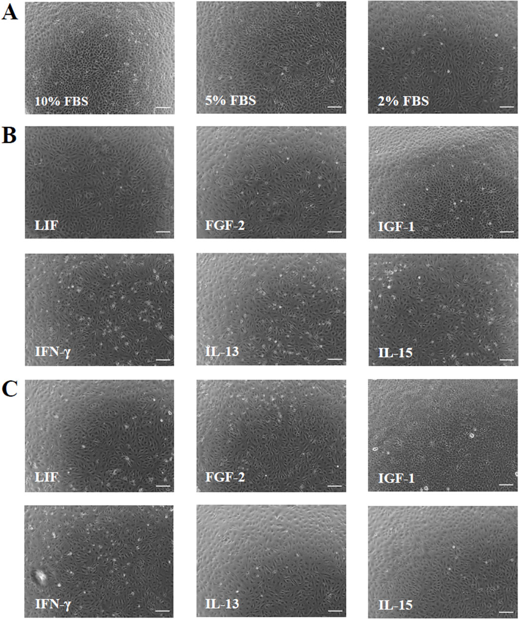 Phase contrast microscopic images of AOXlar7y cells cultivated in 10% FBS, 5% FBS, and 2% FBS. Further 2% FBS cultivated cells were treated with LIF, FGF-2, IGF-1, IFN-γ, IL-13, and IL-15 at two different concentrations, 10 and 50 ng/mL.