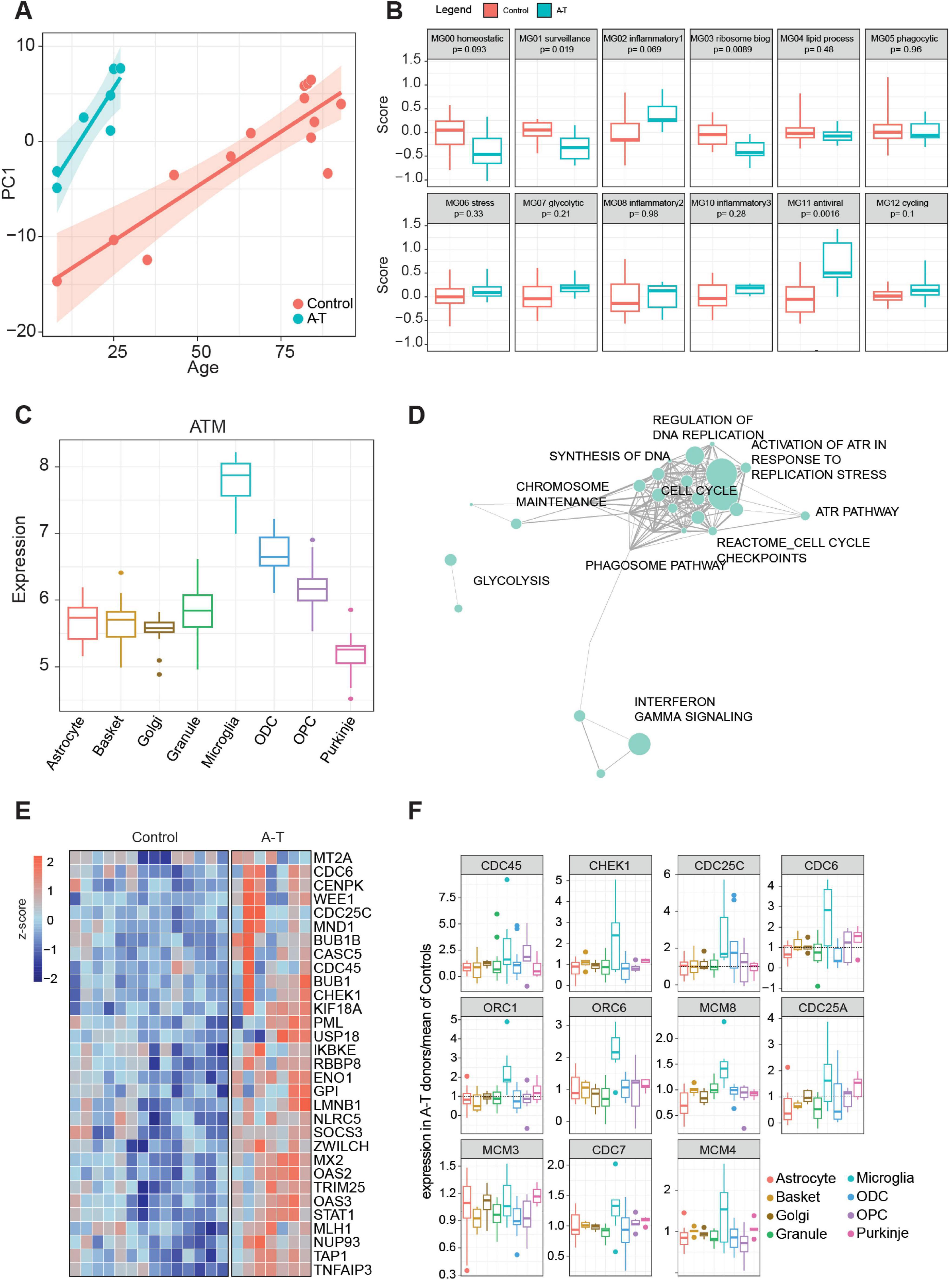 A set of six panels displaying various data visualizations: Panel A is a scatter plot of Principal component 1 versus age, showing different trends for A-T and Control. Panel B shows box plots of expression scores for 12 microglial activation gene sets comparing A-T and Control. C. Panel C shows a box plot illustrating ATM expression across different cell types. Panel D shows a Network diagram highlighting various biological processes such as Glycolysis, Cell Cycle, and DNA Replication regulation. Panel E shows a Heatmap comparing gene expression between control and A-T, with blue to red z-score color gradients. Panel F shows eleven box plots indicating expression levels of genes like CDC45, CHEK1, and ORC1 across different cell types.