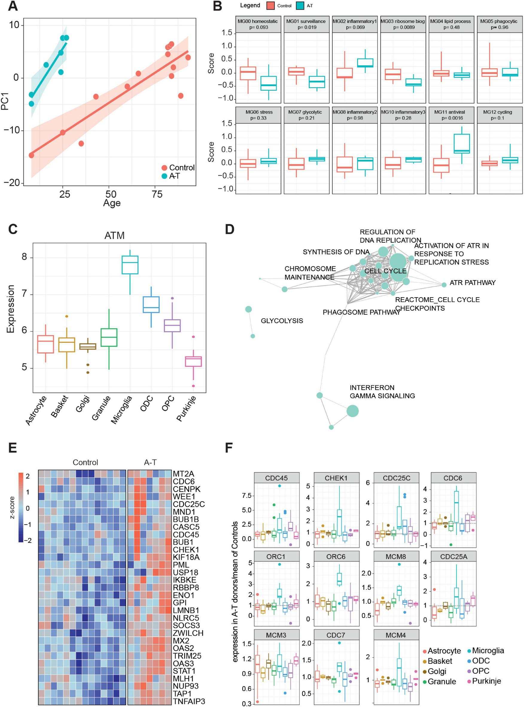 A set of six panels displaying various data visualizations: Panel A is a scatter plot of Principal component 1 versus age, showing different trends for A-T and Control. Panel B shows box plots of expression scores for 12 microglial activation gene sets comparing A-T and Control. C. Panel C shows a box plot illustrating ATM expression across different cell types. Panel D shows a Network diagram highlighting various biological processes such as Glycolysis, Cell Cycle, and DNA Replication regulation. Panel E shows a Heatmap comparing gene expression between control and A-T, with blue to red z-score color gradients. Panel F shows eleven box plots indicating expression levels of genes like CDC45, CHEK1, and ORC1 across different cell types.