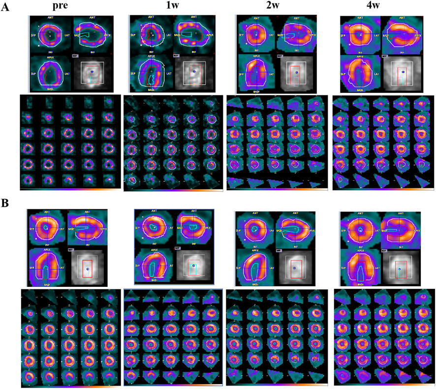 Panels A and B depict a series of medical imaging scans over weeks. Panel A shows scans at pre-treatment, one week, two weeks, and four weeks, highlighting changes in color and structure. Panel B presents a similar progression. Each panel combines larger focused views with smaller arrayed scans, illustrating variations in detail and progression over time. The images use color mapping to indicate different intensities or levels in the scans.