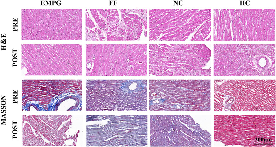 Histological comparison of heart tissues using H&E and Masson staining. Four groups are shown: EMPG, FF, NC, and HC. Each group has pre- and post-treatment images. H&E staining appears in the top two rows, highlighting cellular structure, while Masson staining in the bottom two rows emphasizes collagen. Scale bar indicates 200 micrometers.
