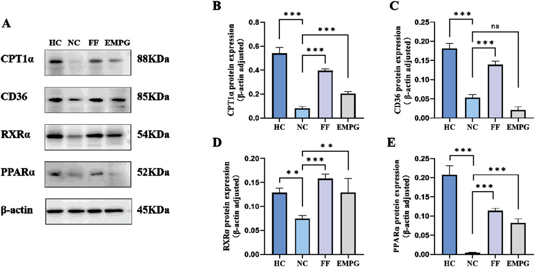 Western blot and bar graphs analyzing protein expression levels. Panel A shows protein bands for CPT1α (88 KDa), CD36 (85 KDa), RXRα (54 KDa), PPARα (52 KDa), and β-actin (45 KDa) across four groups: HC, NC, FF, and EMPG. Panels B to E display bar graphs of protein expression levels adjusted to β-actin, showing varying expression across groups with significance indicated by asterisks.