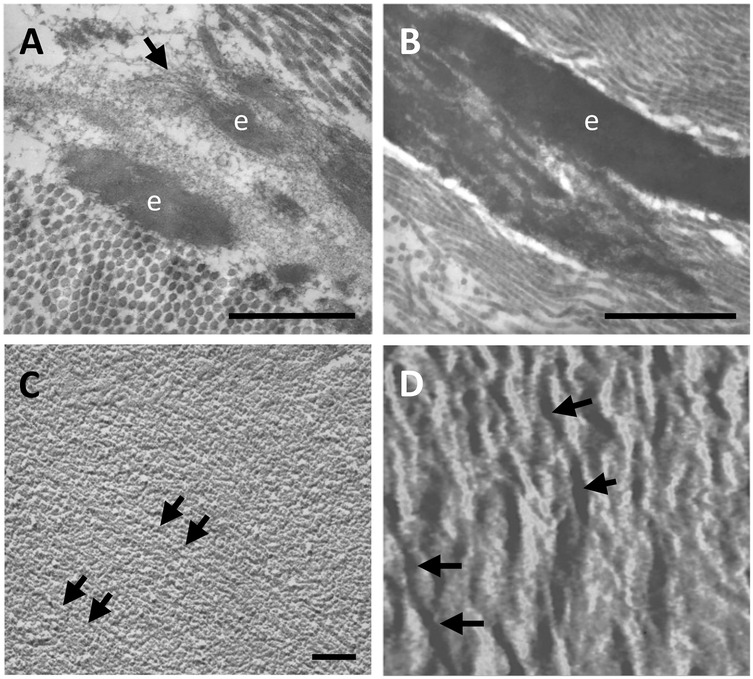 Microscopic images labeled A through D show the structure of elastic fibres. A and B display elongated elastic fibres labeled