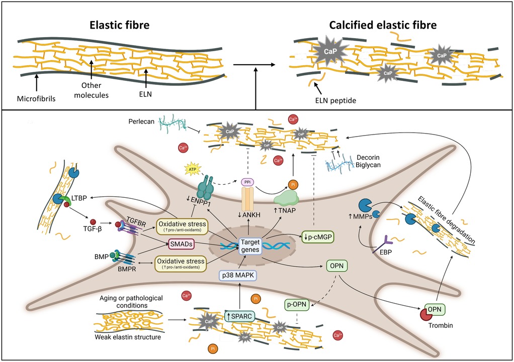 Diagram illustrating the process of elastic fiber calcification. The top section shows a transition from normal elastic fibers, composed of microfibrils and ELN, to calcified fibers with calcium phosphate deposits. The bottom section details cellular pathways involved in this process, highlighting factors like oxidative stress, protein interactions, and gene expression affecting fiber degradation and calcification. Key elements include SMADs, TGF-β, BMP, TNAP, and MMPs, indicating the complex biochemical dynamics in aging or pathological conditions.