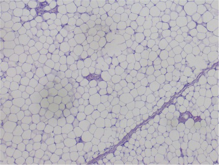 Microscopic image showing a close-up of adipose tissue with numerous white, round cells resembling a honeycomb pattern, separated by thin purple connective tissue strands.