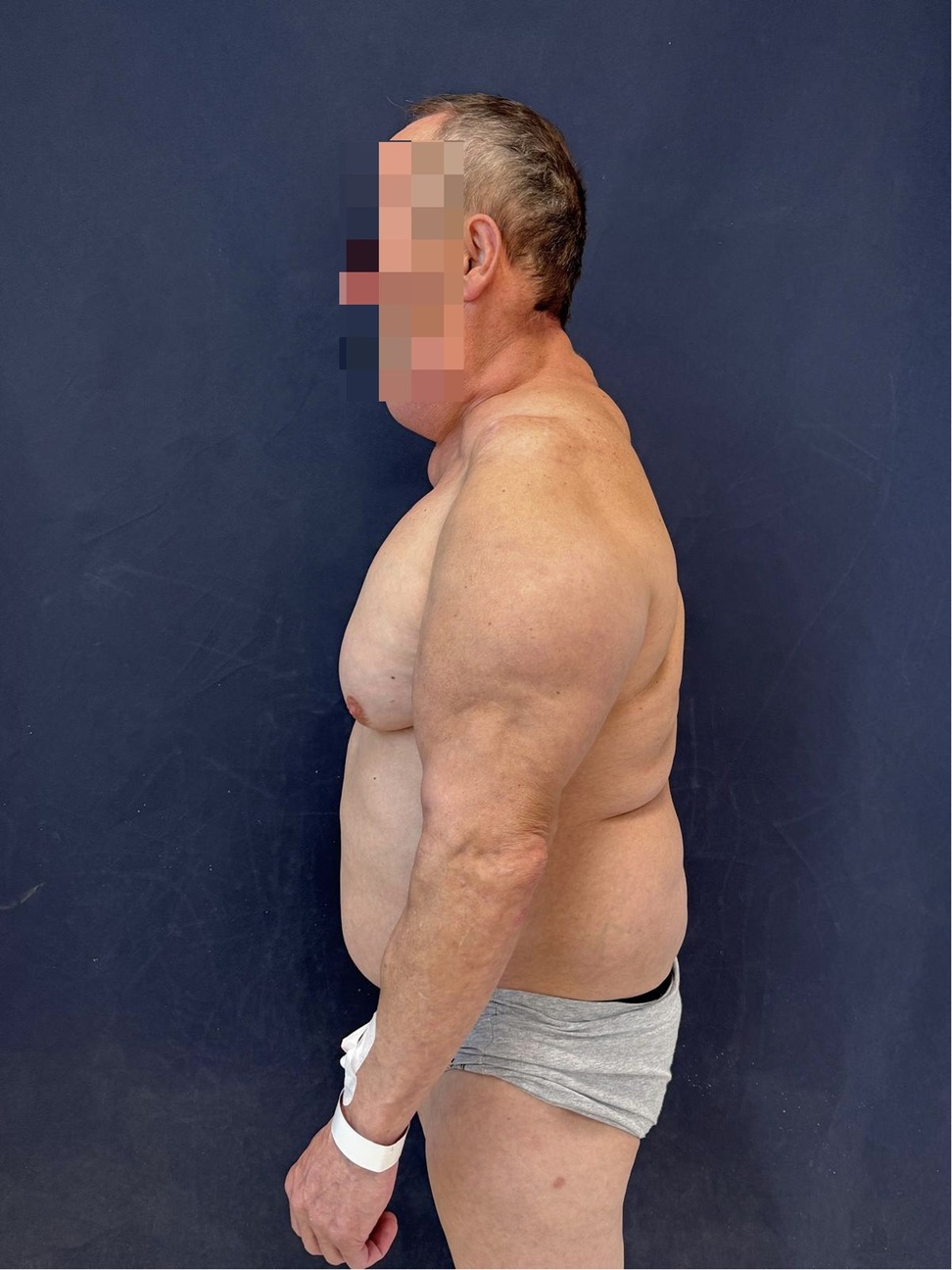 A shirtless man in profile against a dark background. His face is pixelated for privacy. He is wearing gray shorts and a white wristband.
