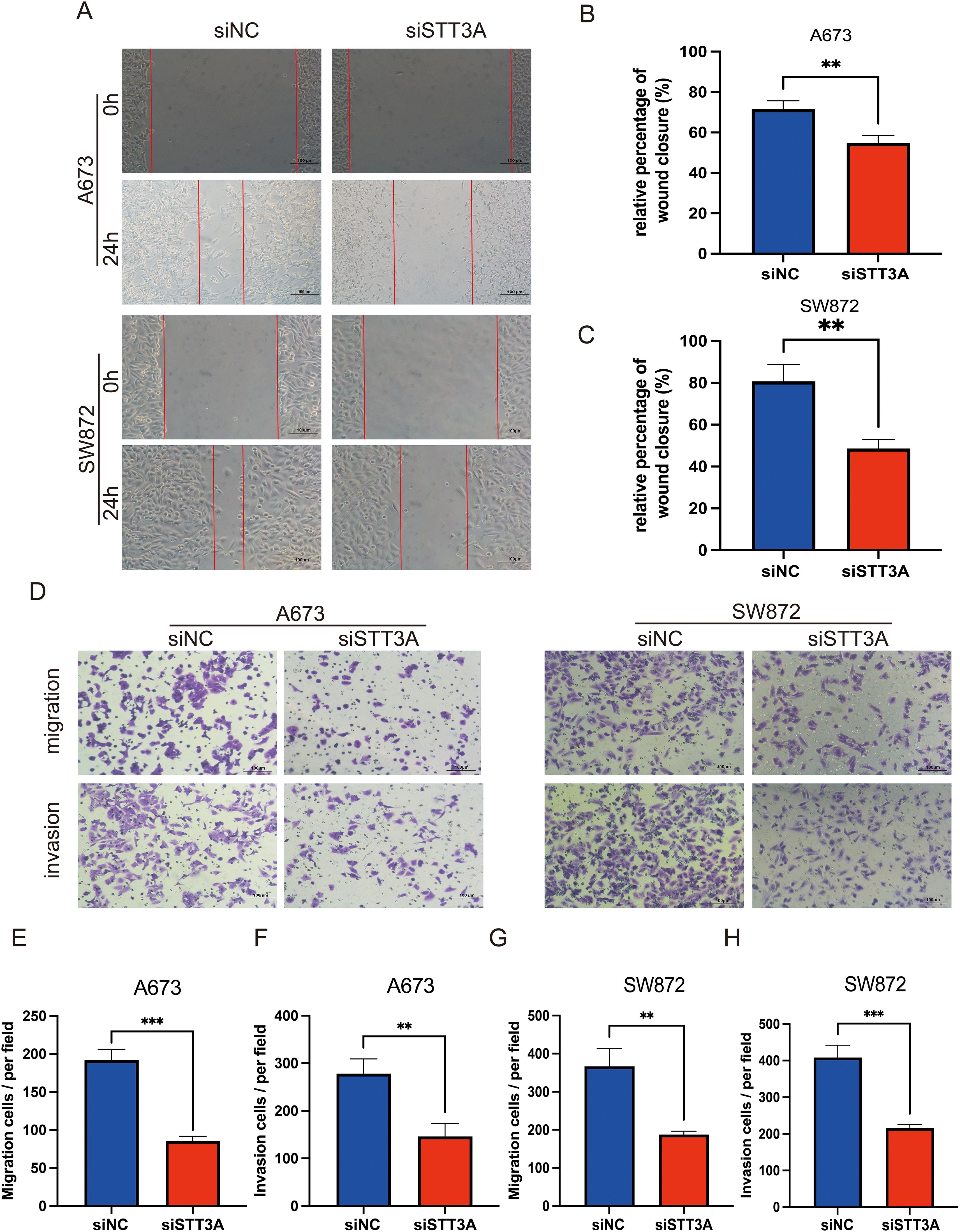 Panel A shows wound healing assays for A673 and SW872 cells treated with siNC and siSTT3A over 24 hours, highlighting reduced wound closure in siSTT3A treatment. Panel B and C are bar charts quantifying wound closure percentage, indicating significant reduction with siSTT3A treatment. Panel D presents images of migrated and invaded cells for both cell lines, showing fewer cells in siSTT3A-treated samples. Panels E, F, G, and H display bar graphs quantifying migrated and invaded cells per field for A673 and SW872, illustrating significant decreases with siSTT3A treatment.