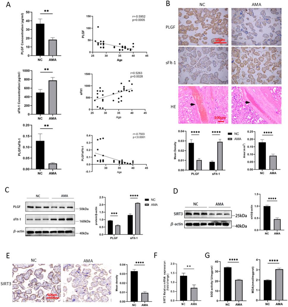 A composite image showing data from a biological study. Panel A: Bar graphs and scatter plots display the concentration of PLGF, sFlt-1, and PLGF/sFlt-1 ratios for NC and AMA groups, with correlation to age. Panel B: Immunohistochemical images for PLGF, sFlt-1, and HE staining, with corresponding quantitative bar graphs. Panel C: Western blot images and bar graph for PLGF and sFlt-1 protein expression. Panel D: Western blot for SIRT3 with bar graph showing expression levels. Panel E: Immunohistochemistry for SIRT3 with density quantification. Panel F and G: Bar graphs for SIRT3 mRNA expression, SOD activity, and MDA levels. Statistical significance is indicated with asterisks.