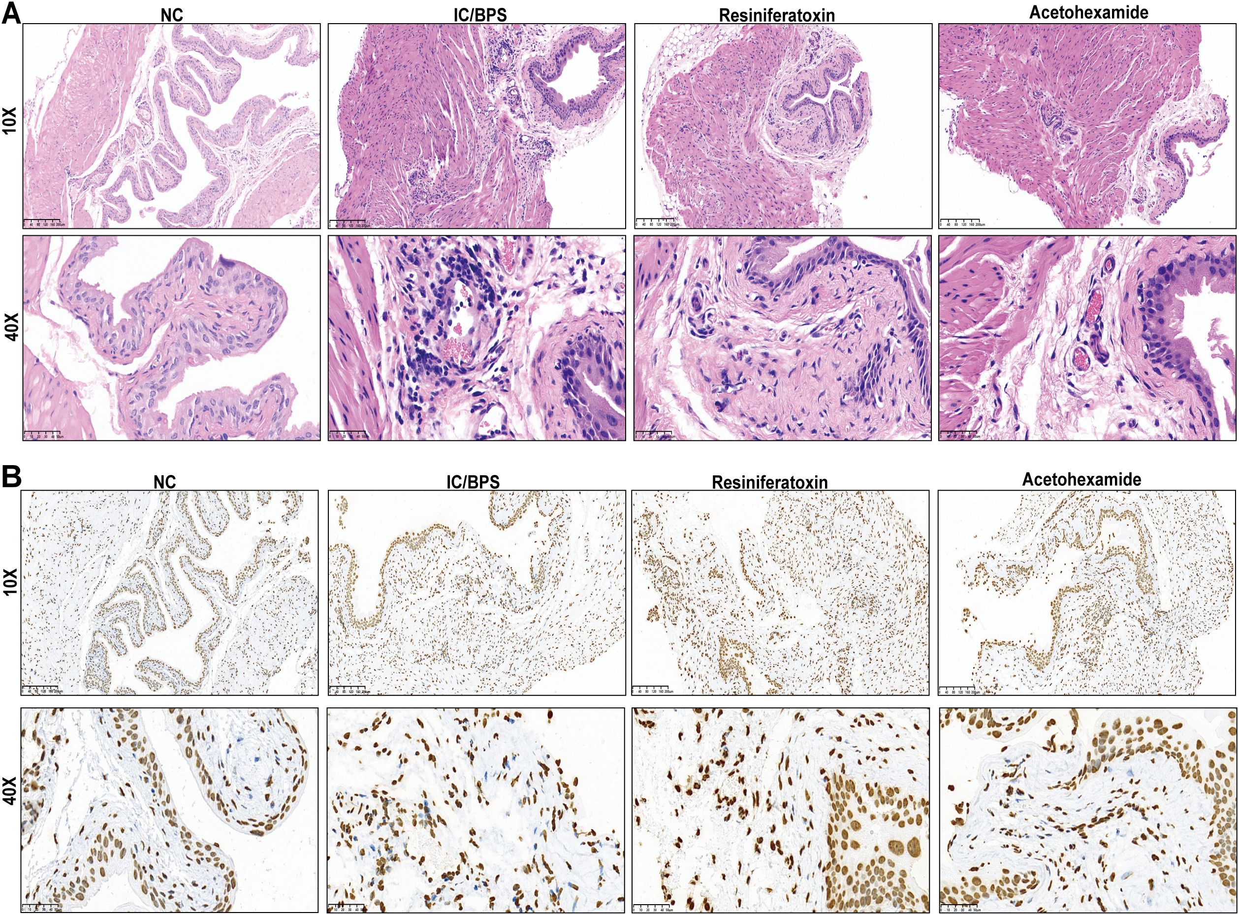 Histological slides showing tissue samples under different treatments at two magnifications, ten times and forty times. Panel A displays hematoxylin and eosin staining for NC, IC/BPS, Resiniferatoxin, and Acetohexamide. Panel B presents immunohistochemical staining for the same groups. The images illustrate cellular and structural differences between treatments.