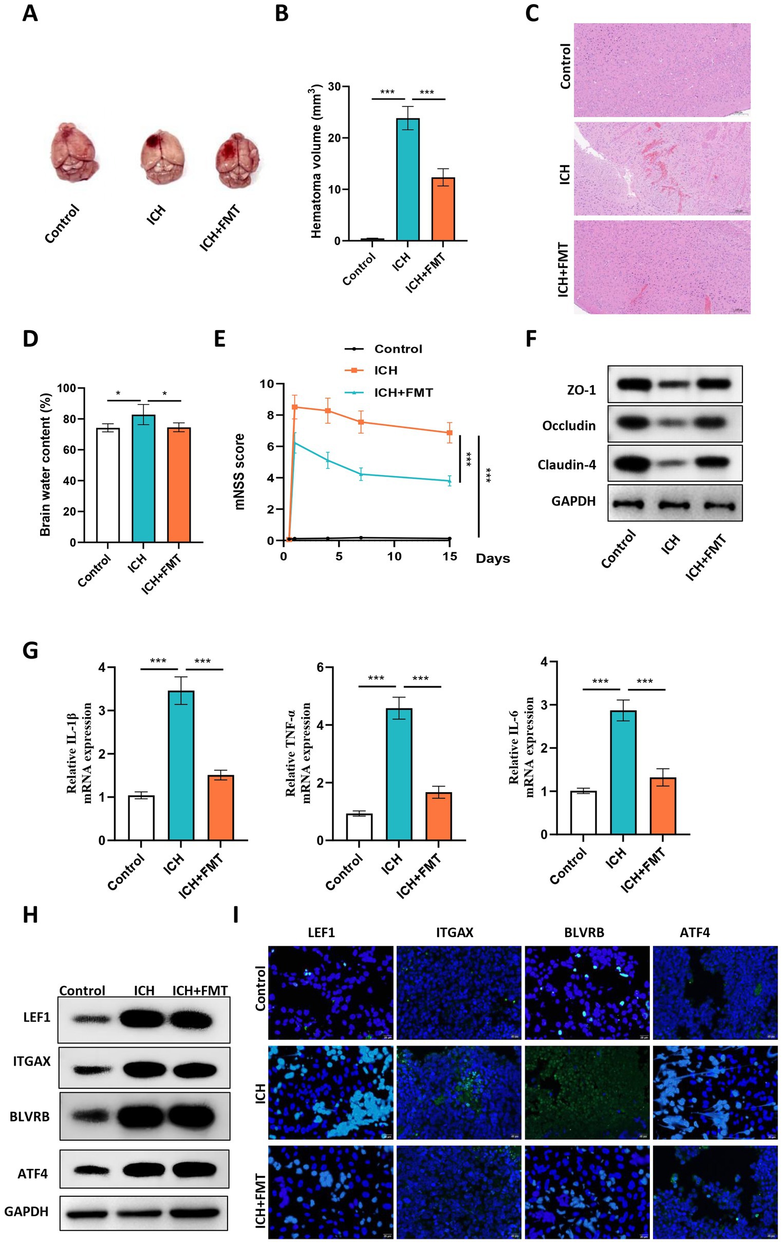 Composite image of multiple scientific panels: (A) Shows brain samples from Control, ICH, and ICH+FMT groups. (B) Bar chart compares hematoma volumes, showing higher volume in the ICH group. (C) Histological slides display tissue differences among groups. (D) Bar chart indicates brain water content, higher in ICH. (E) Line graph of mNSS scores showing recovery trends, with the lowest scores in ICH+FMT. (F) Western blot results for ZO-1, Occludin, Claudin-4, and GAPDH. (G) Bar charts show relative expressions of IL-1β, TNFα, and IL-6 mRNA, highest in ICH. (H) Western blot results for LEF1, ITGAX, BLVRB, ATF4, and GAPDH. (I) Immunofluorescence images show protein expressions across conditions.