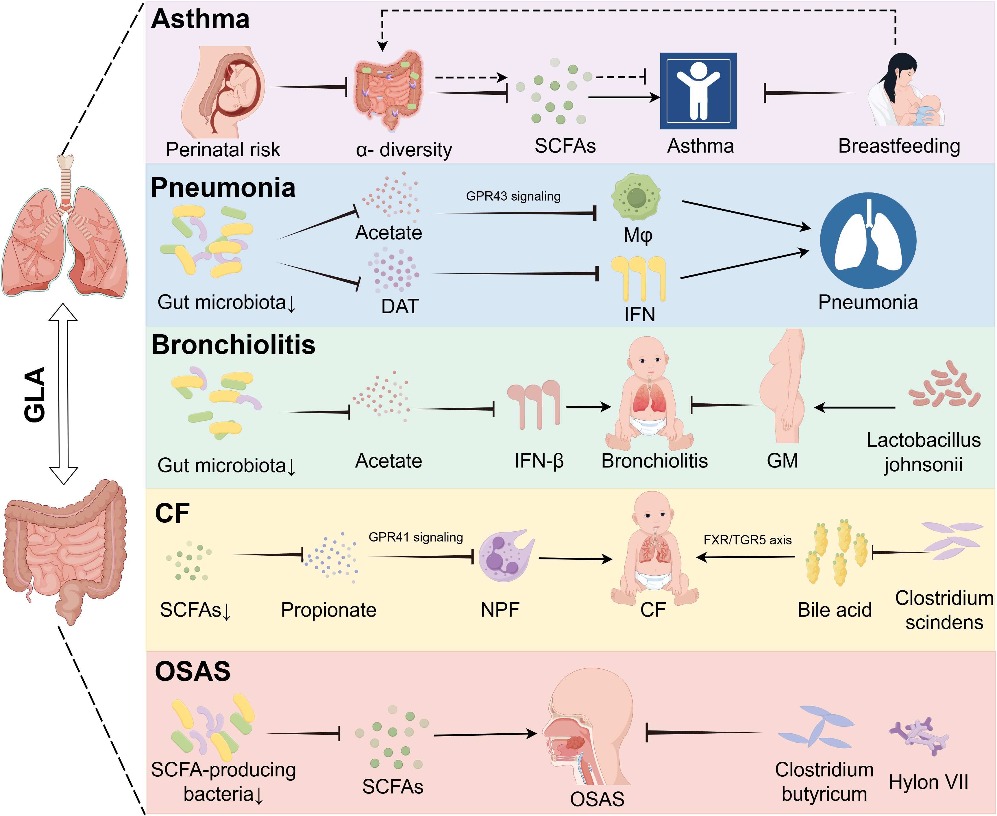 Diagram illustrating the impact of gut-lung axis (GLA) on various respiratory conditions. Different sections show connections between gut microbiota, SCFAs, and conditions like asthma, pneumonia, bronchiolitis, CF (cystic fibrosis), and OSAS (obstructive sleep apnea syndrome). Each condition's pathway involves specific microbial interactions, signaling mechanisms, and impacts on respiratory health, such as diversity and bacterial influences. Arrows and symbols depict relationships and influences between the elements.
