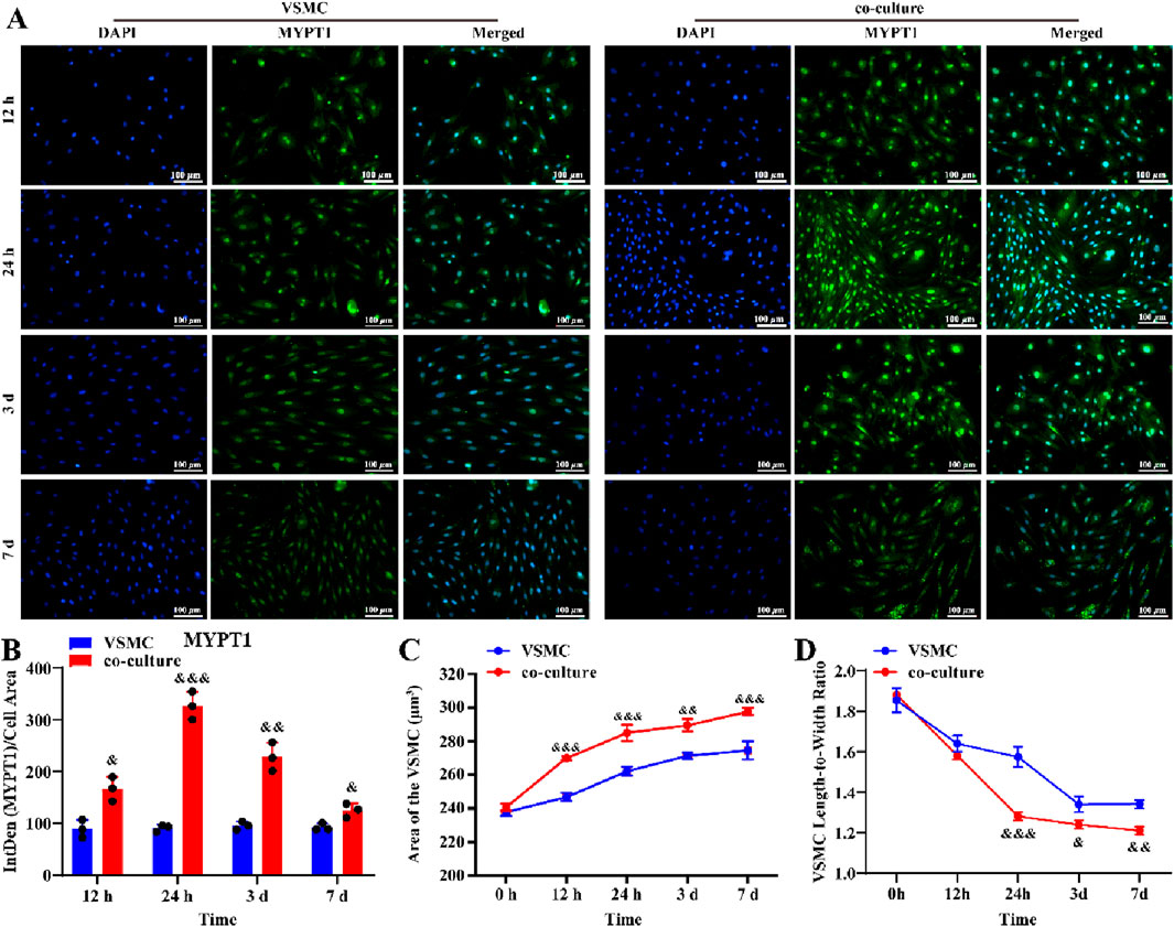 Panel A shows immunofluorescence images of VSMC and co-culture stained with DAPI and MYPT1 at different time points: 12 hours, 24 hours, 3 days, and 7 days. Panel B is a bar graph showing MYPT1 density per cell area for VSMC and co-culture across these time points. Panel C is a line graph depicting the area of VSMC over time. Panel D is a line graph illustrating the VSMC length-to-width ratio over time for both VSMC and co-culture. Various statistical significance markers are included.
