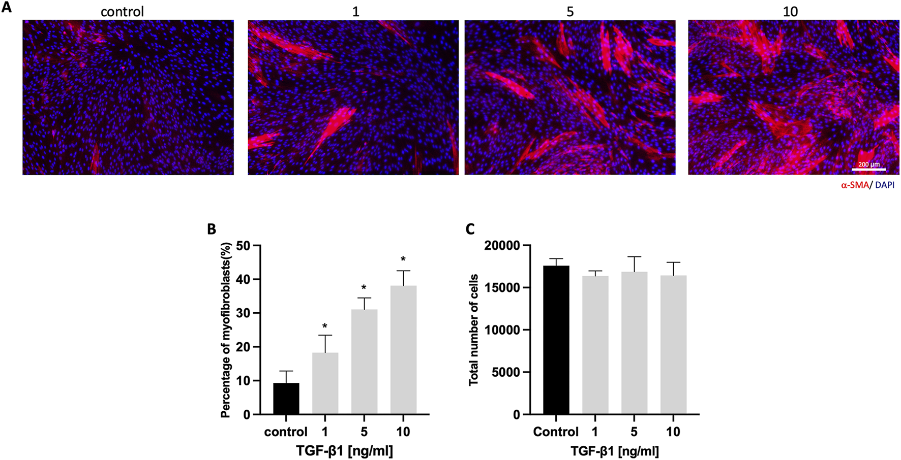 A set of images and graphs showing the effect of TGF-β1 on myofibroblast differentiation. Panel A presents fluorescence images of cells stained with α-SMA (red) and DAPI (blue) under control conditions and with 1, 5, and 10 ng/ml of TGF-β1. Panel B is a bar graph showing the percentage of myofibroblasts increasing with higher TGF-β1 concentrations, while Panel C displays the total number of cells, which remains constant across different TGF-β1 concentrations.