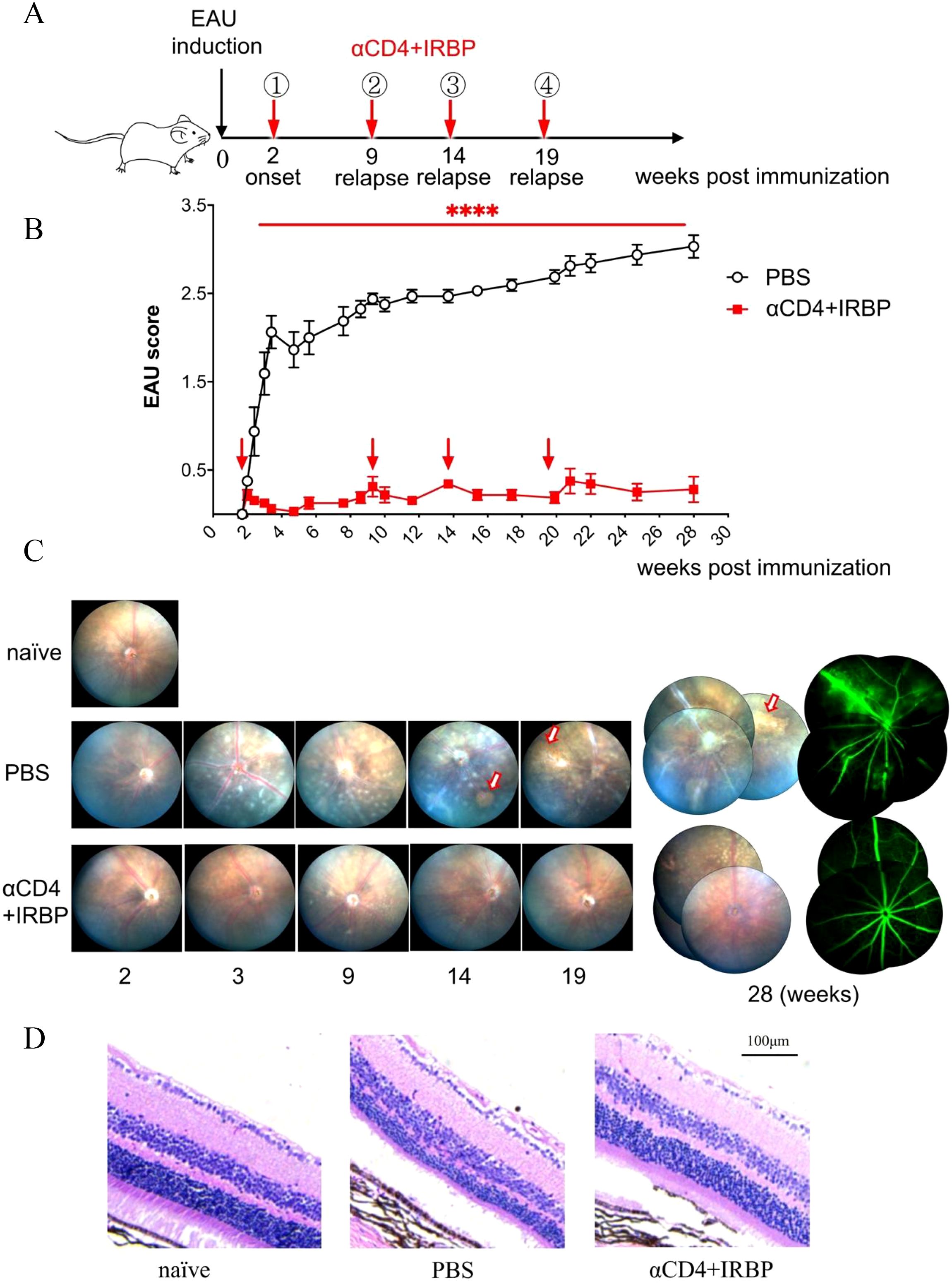 Diagram illustrating experimental autoimmune uveitis (EAU) in mice. Panel A shows EAU induction over weeks with treatment injections. Panel B is a graph of EAU scores, comparing PBS and αCD4+IRBP treatments. Panel C displays fundus images at various weeks, showing retinal changes across treatments. Panel D presents histological retinal sections for naïve, PBS, and αCD4+IRBP groups.
