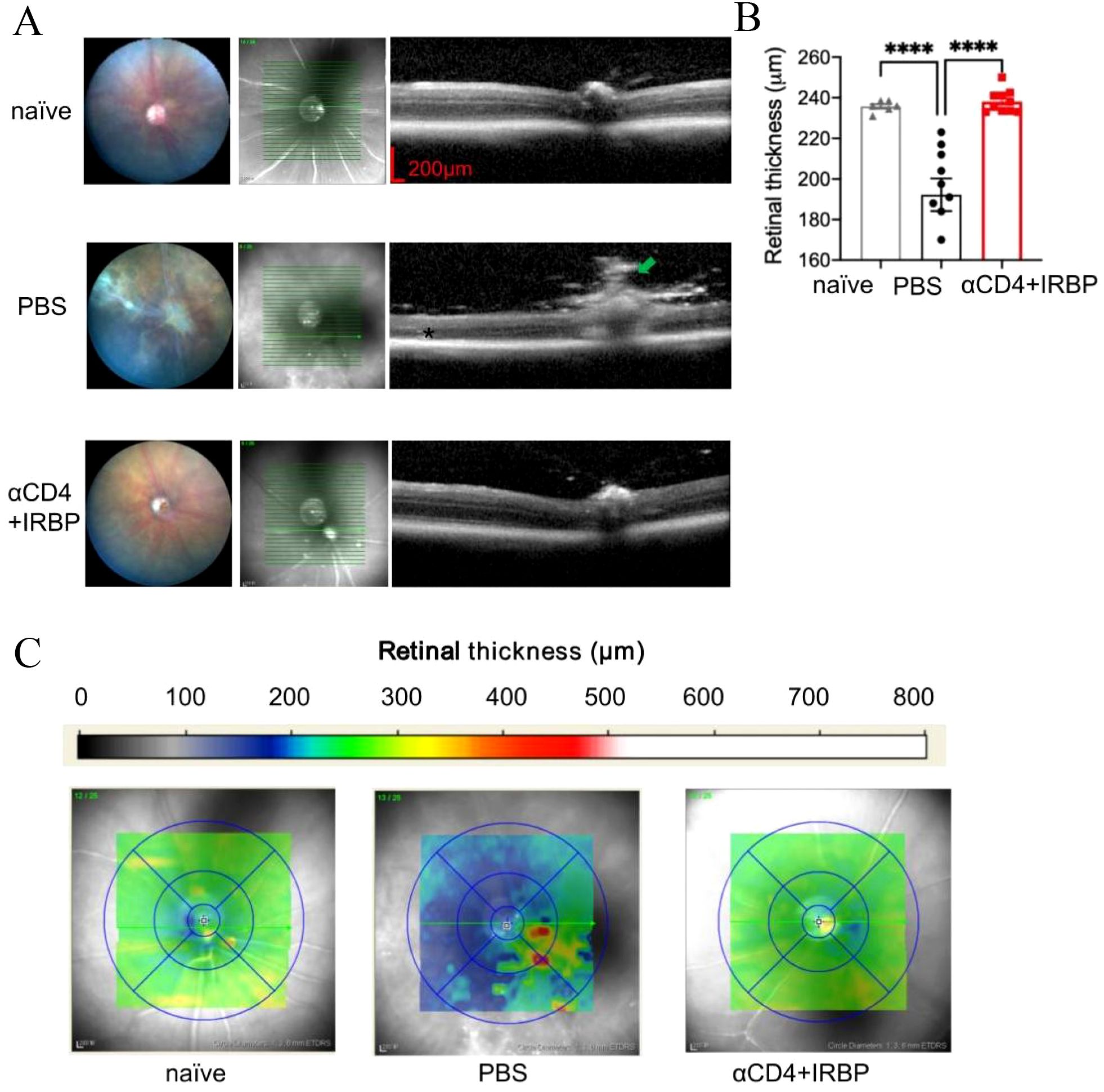 Three panels depict retinal imaging and analysis. Panel A shows fundus images and OCT scans for naïve, PBS, and αCD4+IRBP treatments, highlighting retinal thickness variations. Panel B presents a bar graph comparing retinal thickness across treatments, indicating significant differences, particularly in αCD4+IRBP. Panel C includes color-coded maps illustrating retinal thickness distribution, with a color scale ranging from 0 to 800 micrometers.