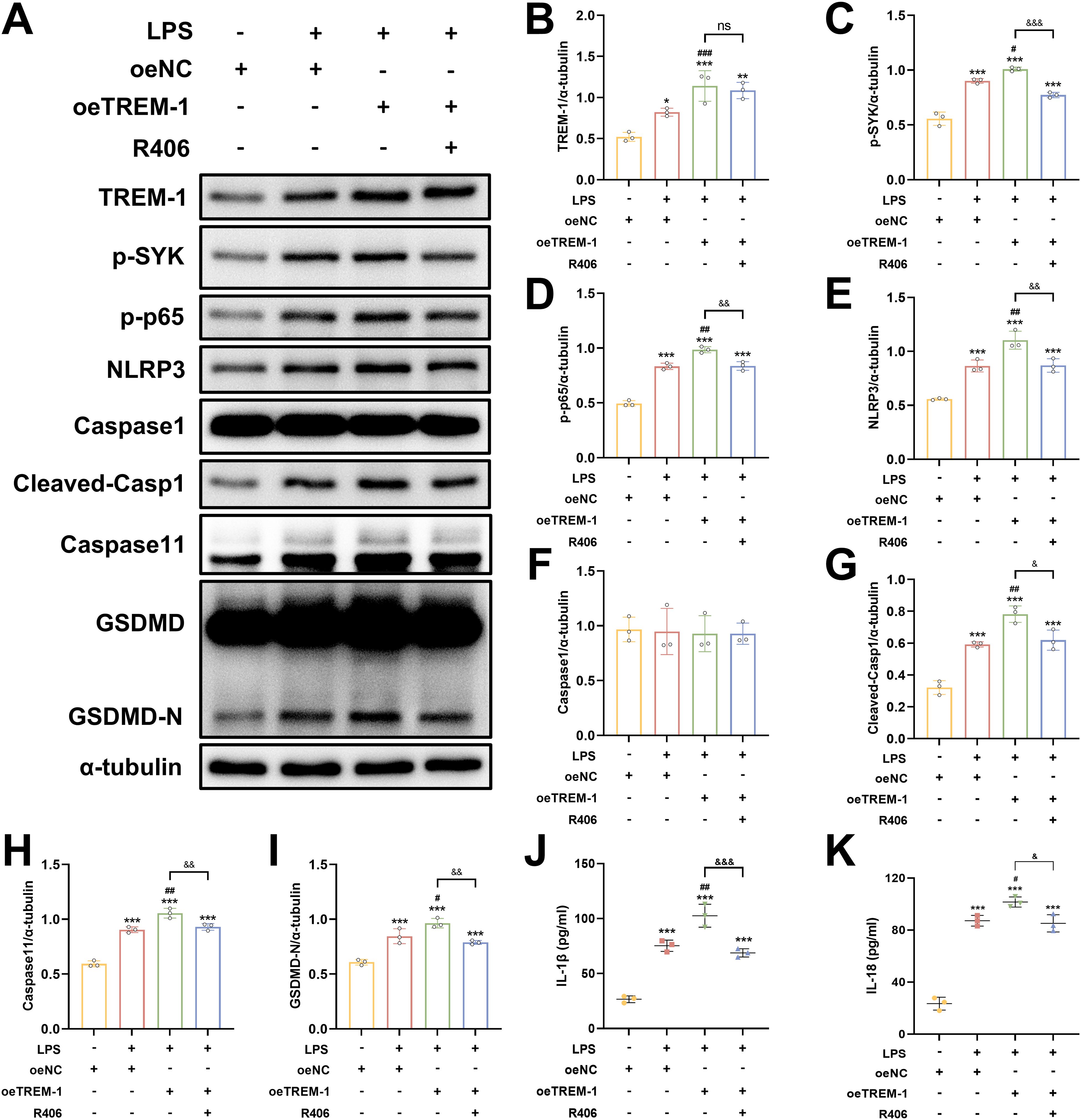 Western blot and bar graph results depict the expression levels of various proteins and cytokines under different conditions. The proteins include TREM-1, p-SYK, p-p65, NLRP3, Caspase 1, Cleaved-Caspase 1, Caspase 11, GSDMD, GSDMD-N, and α-tubulin. Bar graphs present quantifications of these proteins, showing statistical significance in response to treatments with LPS, oeNC, oeTREM-1, and R406. Cytokine levels IL-1β and IL-18 are also measured, highlighting changes across treatments. Statistical significance is marked with asterisks and symbols.