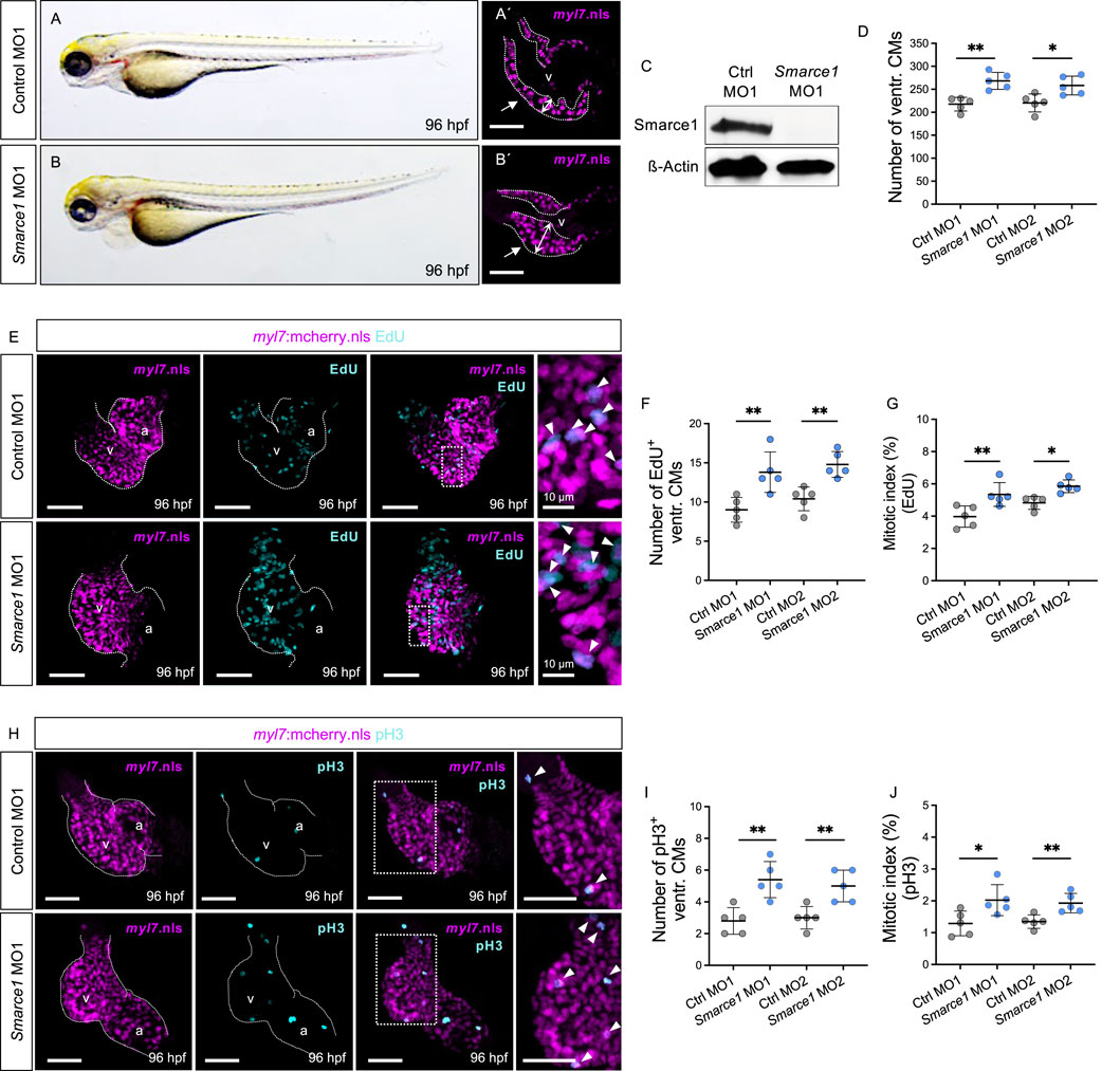 Zebrafish larvae images with molecular and cellular analyses. Panels A and B show larvae at 96 hours post-fertilization for control and Smarce1 knockdown groups, respectively, with corresponding muscle gene expression displayed in A′ and B′. Panel C presents a Western blot showing Smarce1 and beta-Actin levels. Panel D is a graph comparing ventricular cardiomyocyte numbers across treatments. Panel E displays myl7:nls and EdU staining, with quantification in F and G. Panel H shows myl7:nls and pH3 staining, with related data in I and J. Scale bars and relevant structures are labeled.