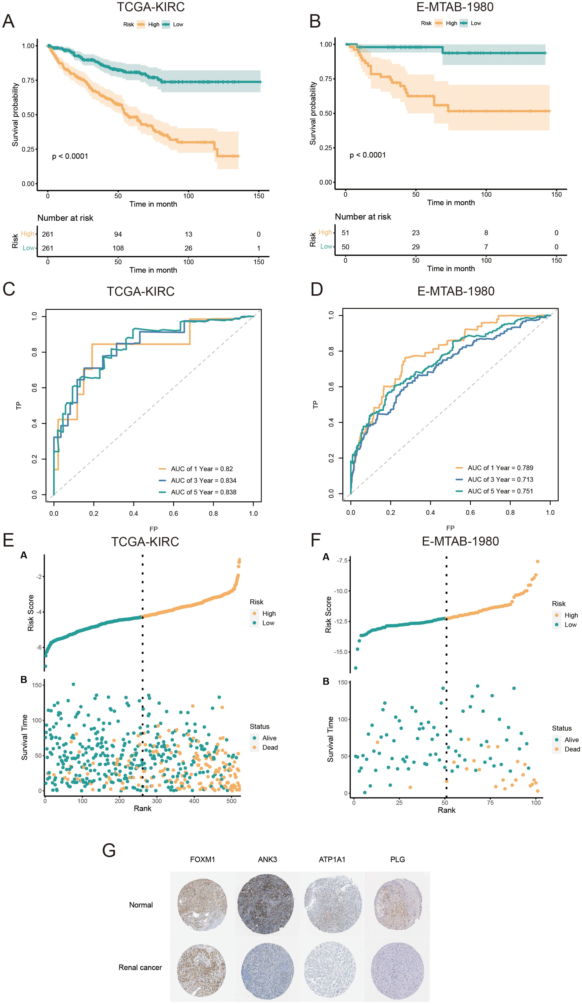 Validation and prognostic performance of the AICD-related signature in KIRC patients. OS of LR and HR patients in the TCGA-KIRC (A) and E-MTAB-1980 (B) cohorts. ROC curves of the prognostic model for estimating survival in the TCGA-KIRC (C) and E-MTAB-1980 (D) cohorts. (Risk score distribution stratified by survival status and time in the TCGA-KIRC (E) and E-MTAB-1980 (F) cohorts. (G) Expression of core prognostic model genes in renal cancer and normal tissues via the HPA database.