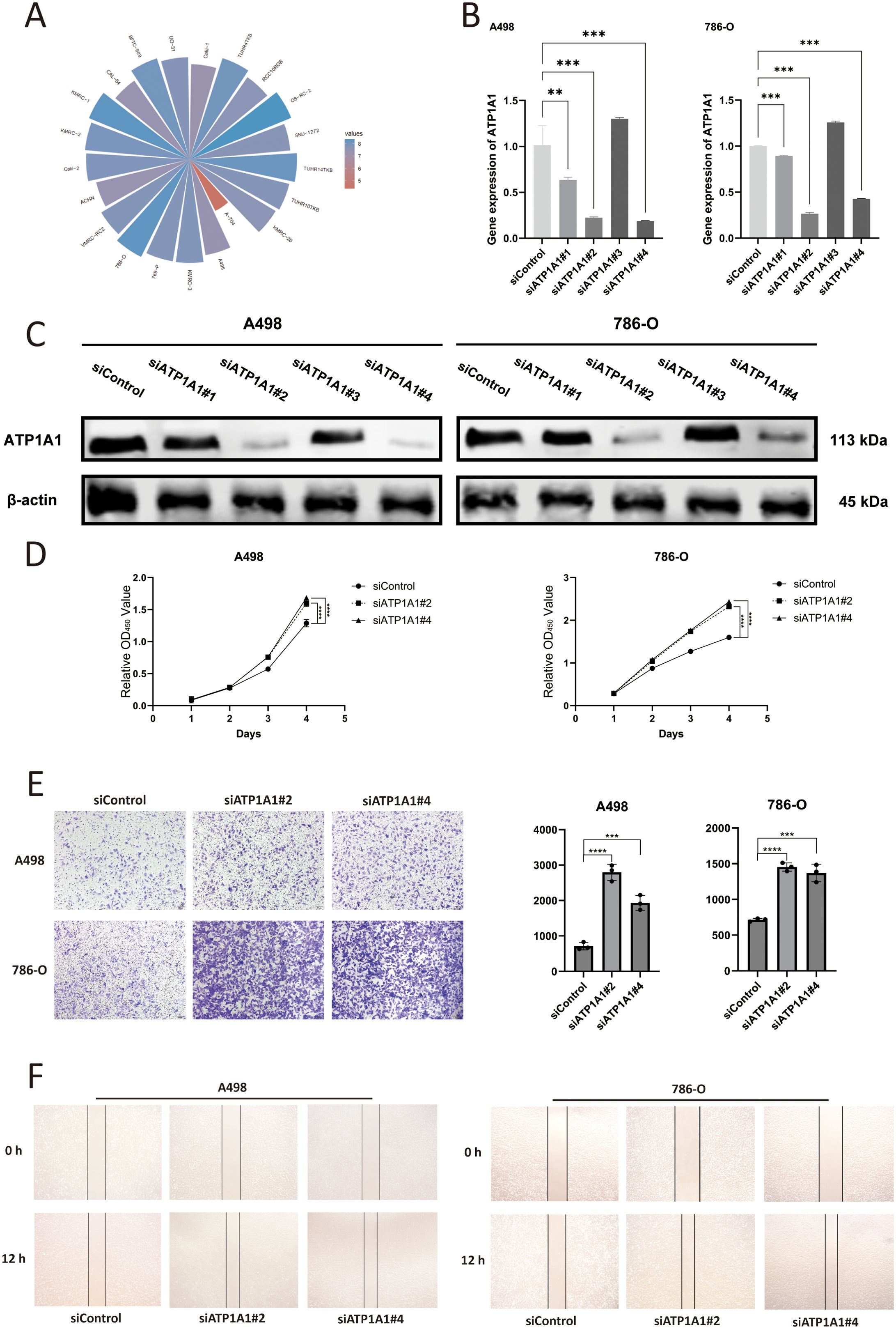 The effect of ATP1A1 gene knockdown on the malignant biological functions of RCC cells. (A) ATP1A1 expression across RCC cell lines based on CCLE data. (B) mRNA level of ATP1A1 after siATP1A1 transfection. (C) Western blot analyses confirm the efficiency of ATP1A1 knockdown in A498 and 786-O cells. (D) Cell proliferation after ATP1A1 knockdown. (E) A498 and 786-O cells transwell invasion image after ATP1A1 knockdown. (F) A498 and 786-O cells scratching after ATP1A1 knockdown.
