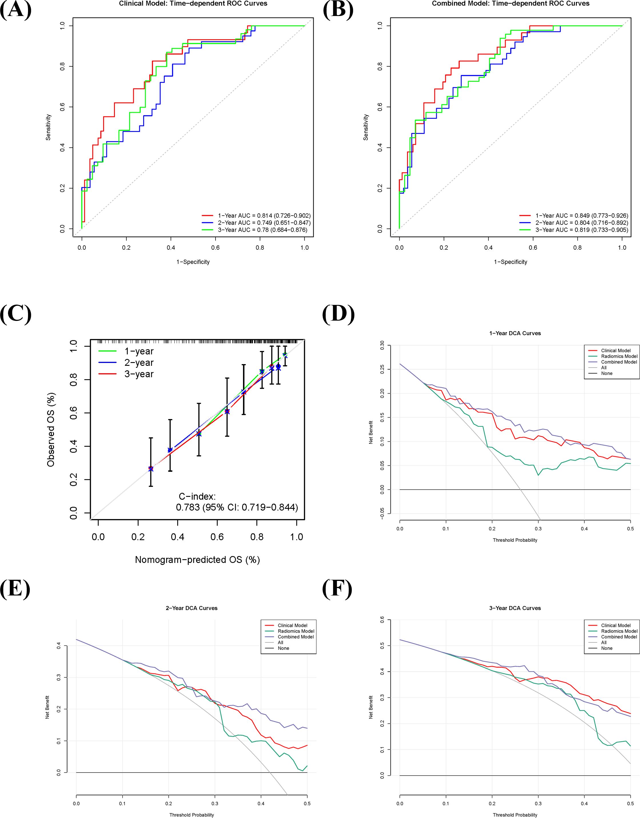 (A) Time-dependent ROC curve for the clinical model showing AUC values: 1-year is 0.814, 2-year is 0.749, 3-year is 0.78. (B) Time-dependent ROC curve for the combined model with AUC values: 1-year is 0.849, 2-year is 0.804, 3-year is 0.819. (C) Calibration plot comparing observed and predicted overall survival (OS) percentages over one to three years, with a C-index of 0.783. (D) One-year DCA curves for clinical, radiomic, combined models, and none, showing net benefit versus threshold probability. (E) Two-year DCA curves showing similar model comparisons. (F) Three-year DCA curves with similar comparisons.