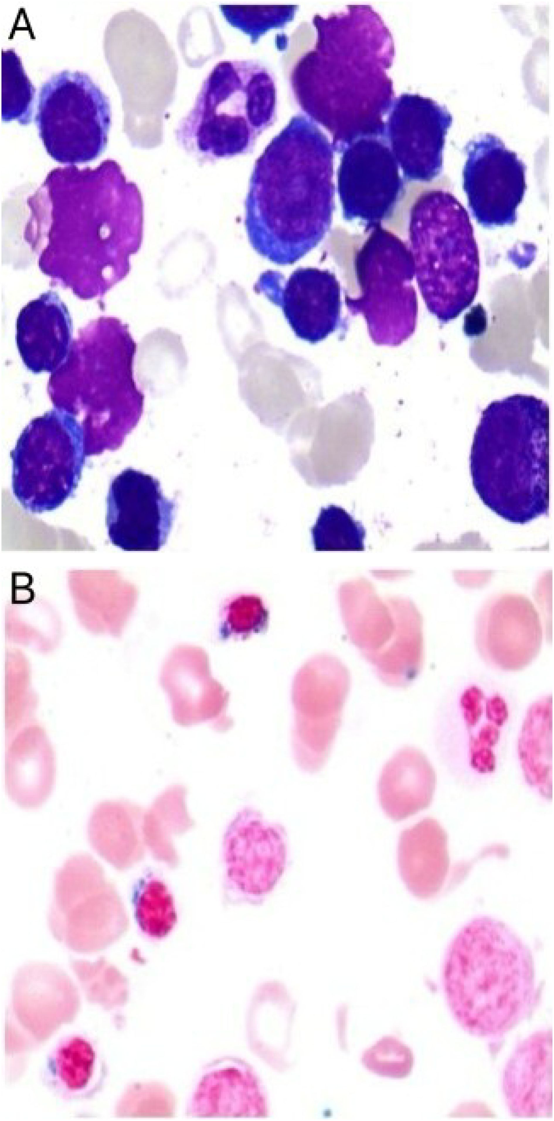 Two microscopic images labeled A and B. Image A shows cells stained in varying shades of blue and purple, highlighting different cell structures. Image B displays cells stained primarily in pink, with some red and purple areas, indicating different components or types of cells.