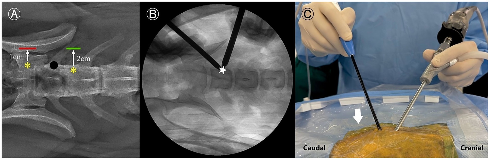 Panel A shows an X-ray of the cervical spine with red and green lines indicating distances of 1 cm and 2 cm respectively. Yellow asterisks and a black dot mark specific areas. Panel B shows a close-up X-ray view with a tool positioned near a white star marker. Panel C depicts a medical procedure with gloved hands using a handheld instrument over a covered surgical area marked with