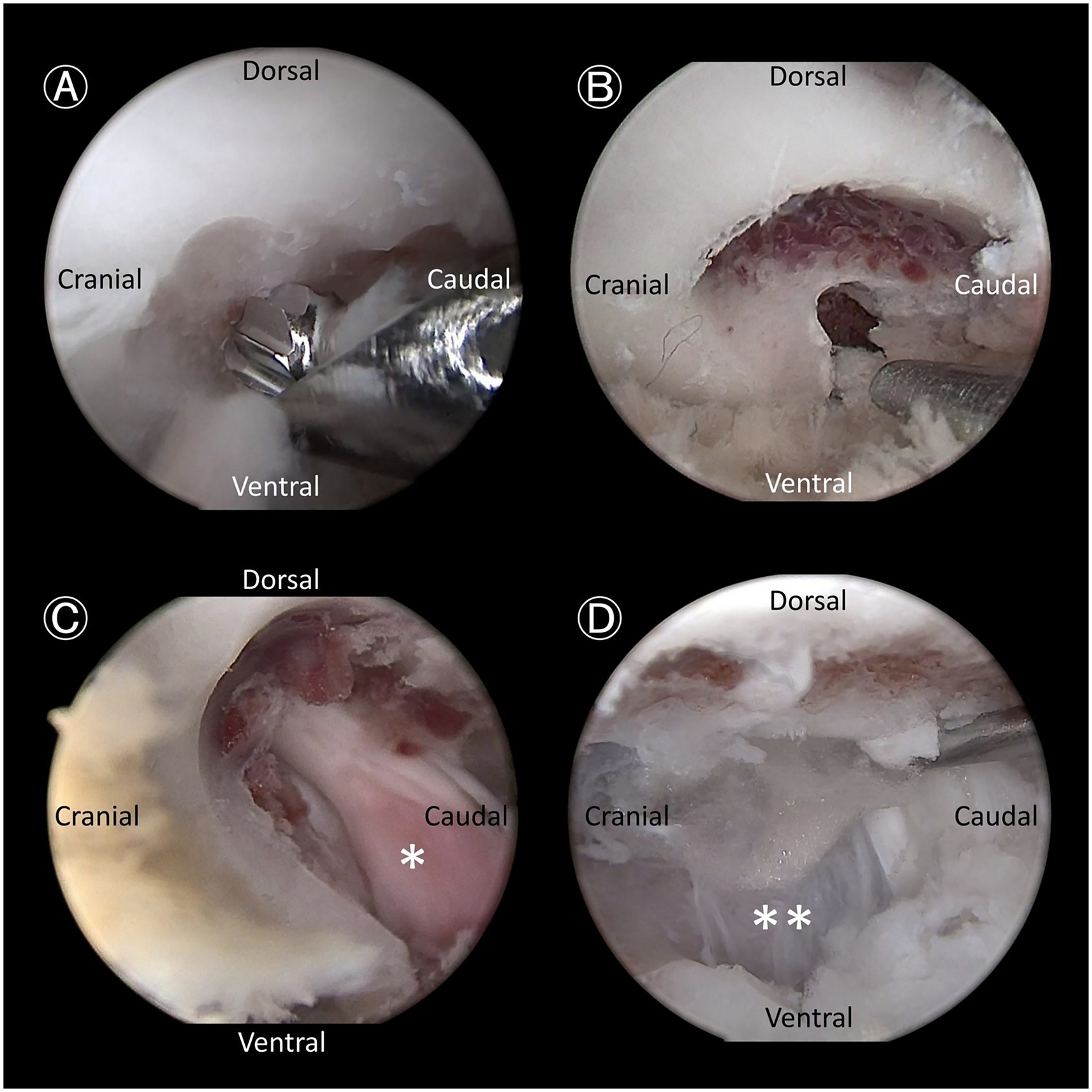 Arthroscopic images showing four stages of a knee procedure. Panel A shows a surgical tool near tissue. Panel B shows a cleaned surface with visible cartilage. Panel C highlights a tissue area with a single asterisk. Panel D shows a repaired area marked by two asterisks. Orientation labels include dorsal, ventral, cranial, and caudal.