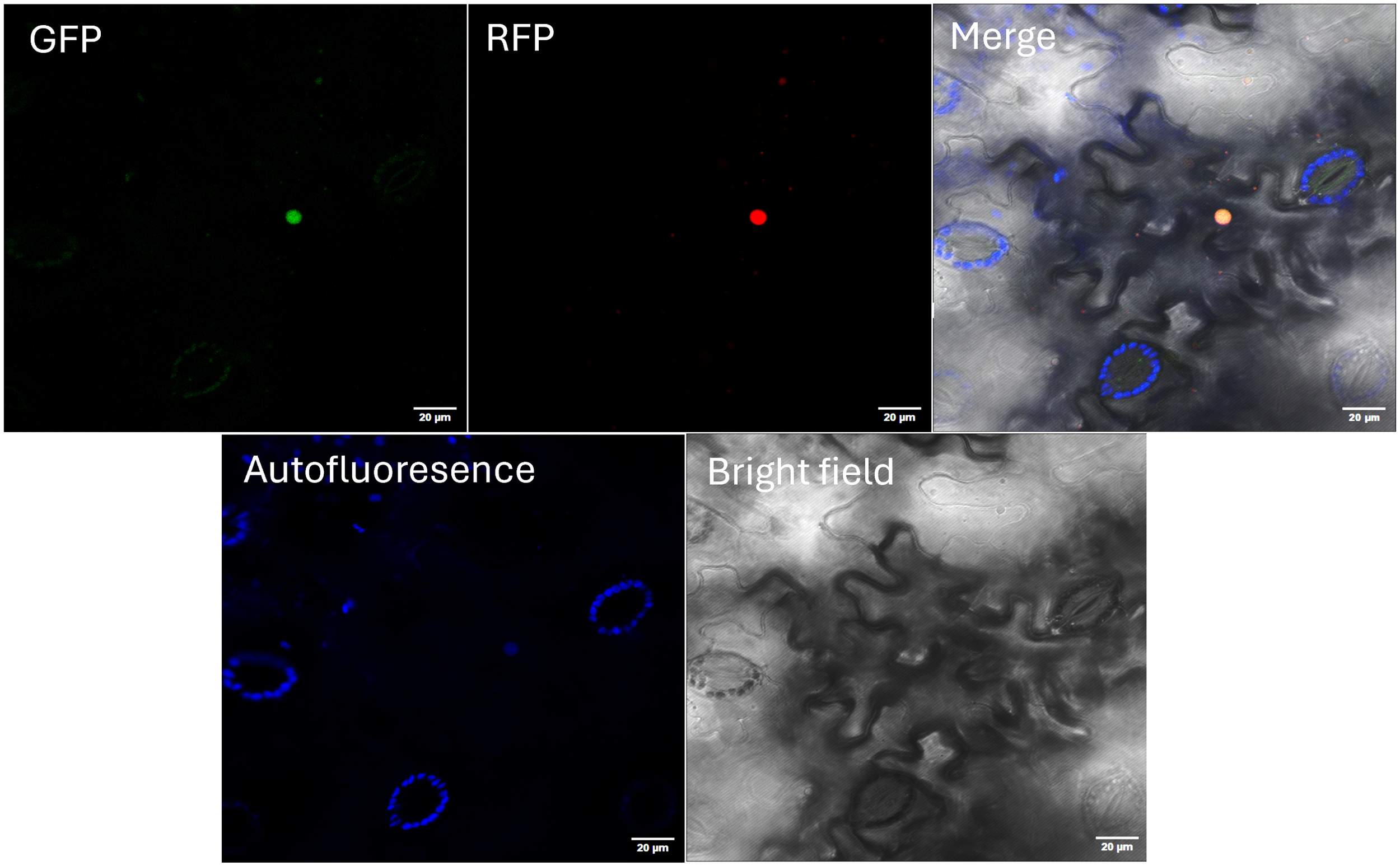 Fluorescence microscopy images of plant cells. Please remove plant stomata. Top middle shows RFP fluorescence in red. Top right is a merged image with GFP, RFP, and autofluorescence. Bottom left displays blue autofluorescence. Bottom right is a bright-field image, detailing stomatal structures in grayscale. Scale bars indicate 20 micrometers.