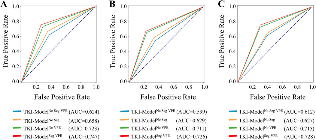 Three ROC curve plots labeled A, B, and C compare the performance of four TKI-Models in terms of true positive rate versus false positive rate. Each plot shows curves representing models with variations of segmentation and VPE adjustments. Models are color-coded: blue, orange, green, and red with respective AUC values shown in the legend. AUC values range from approximately 0.599 to 0.747, demonstrating varying levels of predictive performance.