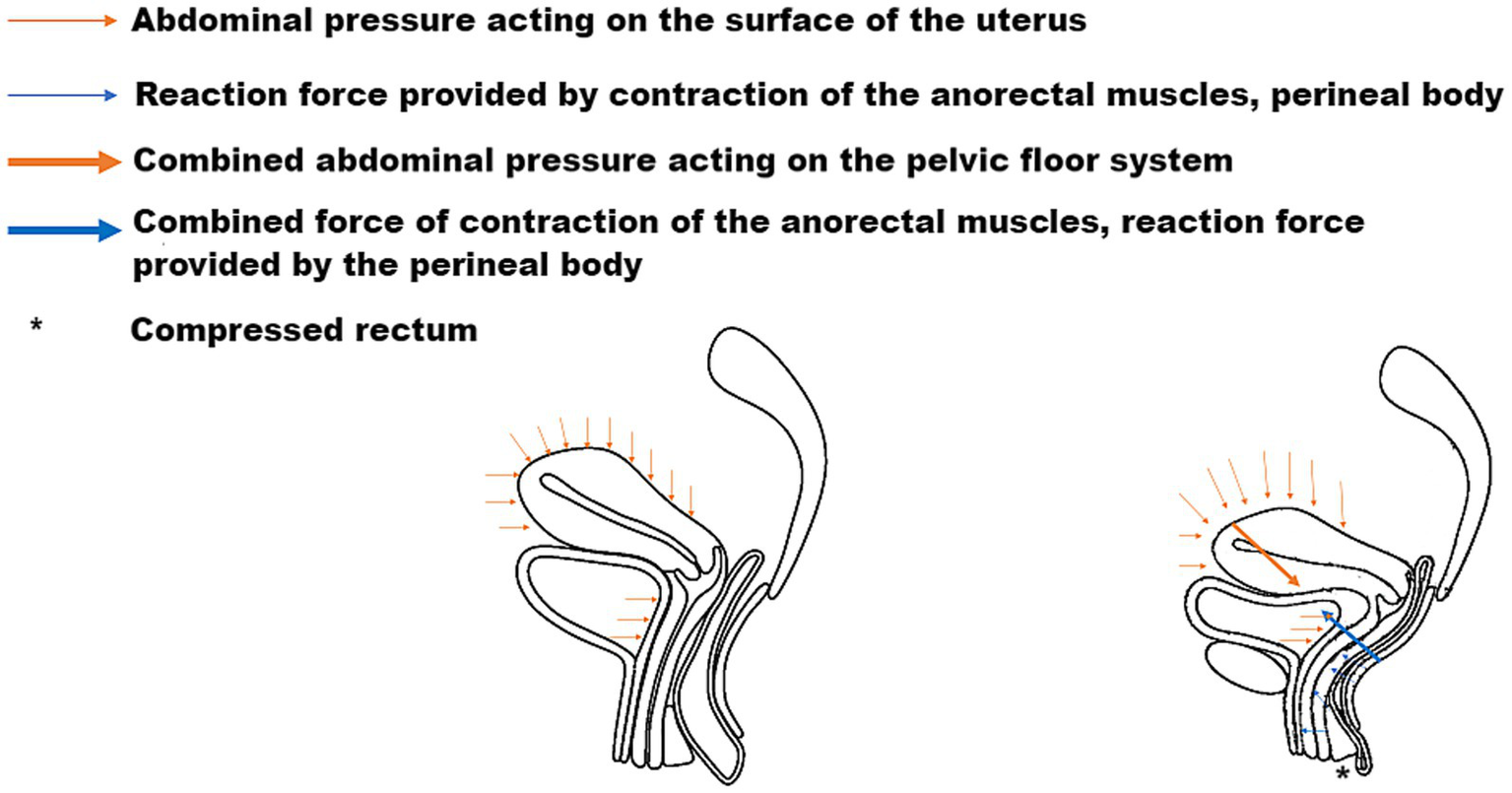 Diagram illustrating forces acting on the pelvic floor. Arrows show abdominal pressure on the uterus, reaction forces from anorectal muscles, combined pressures, and contraction forces. The rectum is marked as compressed.