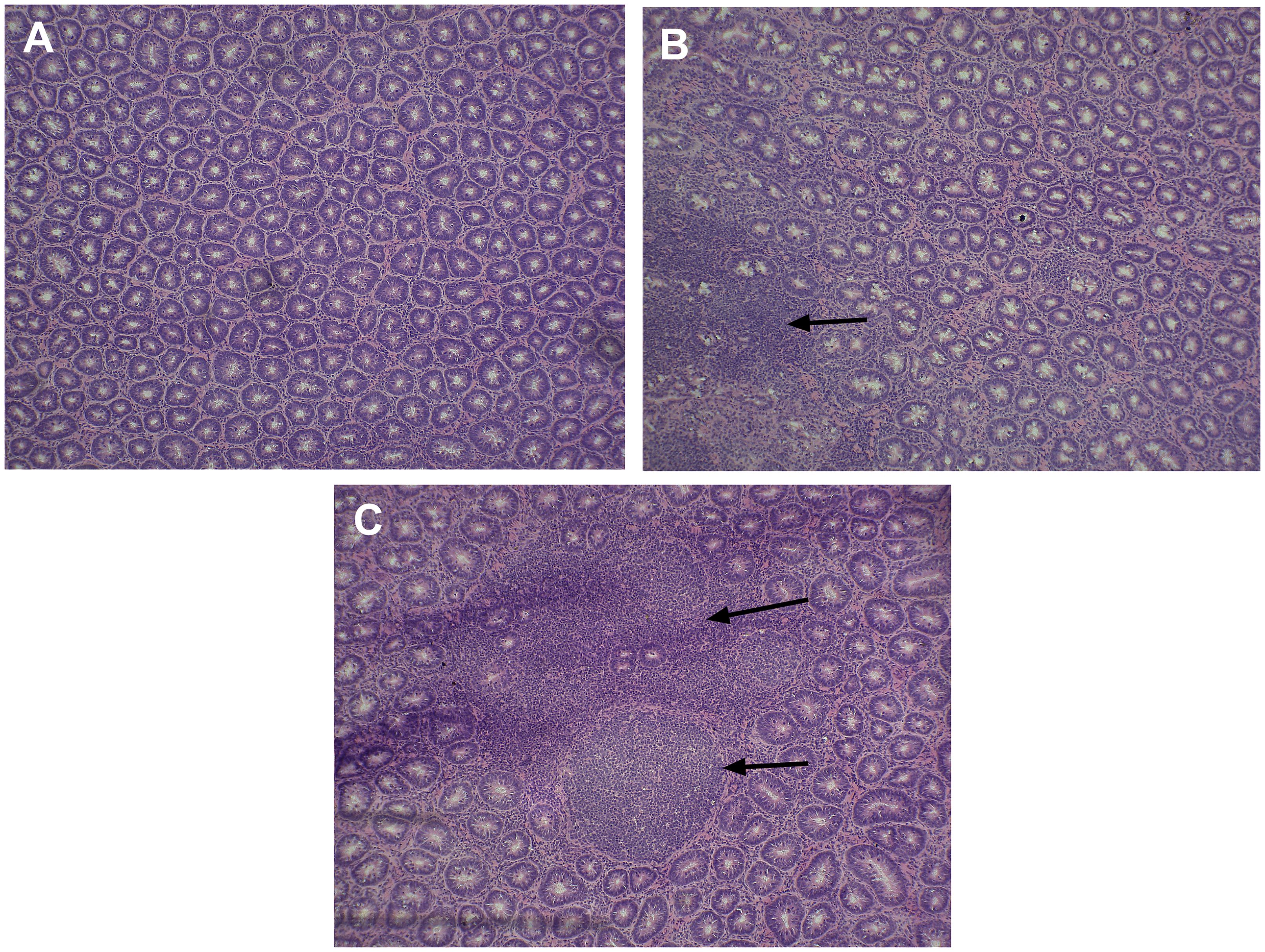 Histological images labeled A, B, and C. Image A shows densely packed circular structures. Image B has similar structures with an arrow pointing to an area of interest. Image C displays more pronounced structures with two arrows indicating specific regions. Each image shows variations in cellular organization.