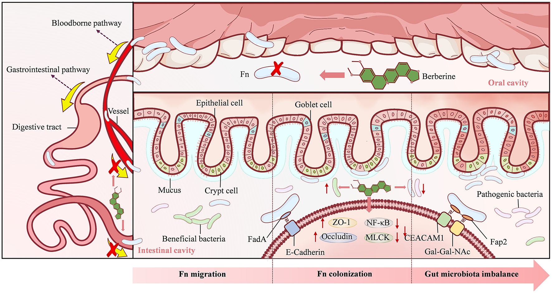 Diagram illustrating the pathways of Fusobacterium nucleatum (Fn) from the oral cavity to the intestinal cavity. It shows the gastrointestinal and bloodborne pathways, the effect of berberine, epithelial cell interactions, and the impact on gut microbiota balance. Key elements include mucus, crypt cells, beneficial and pathogenic bacteria, and proteins like E-Cadherin and CEACAM1.