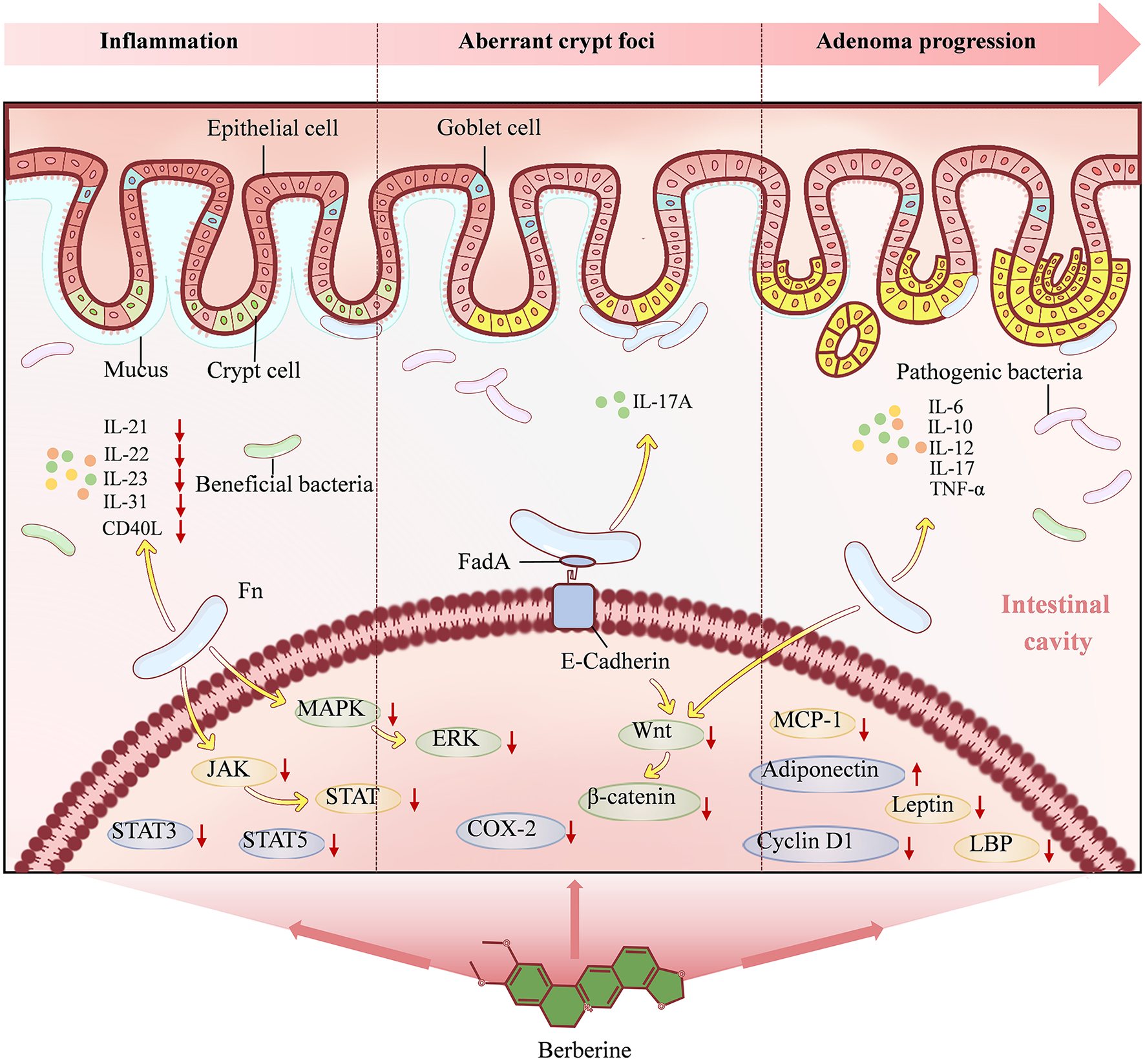 Illustration of intestinal mucosa showing stages of inflammation, aberrant crypt foci, and adenoma progression. Epithelial and goblet cells are labeled, showing interactions with bacteria and signaling molecules like IL-21, IL-17A, and TNF-alpha. Pathways involving JAK/STAT, MAPK, and Wnt/β-catenin are depicted. Berberine is indicated at the bottom, pointing to its role in influencing these processes.