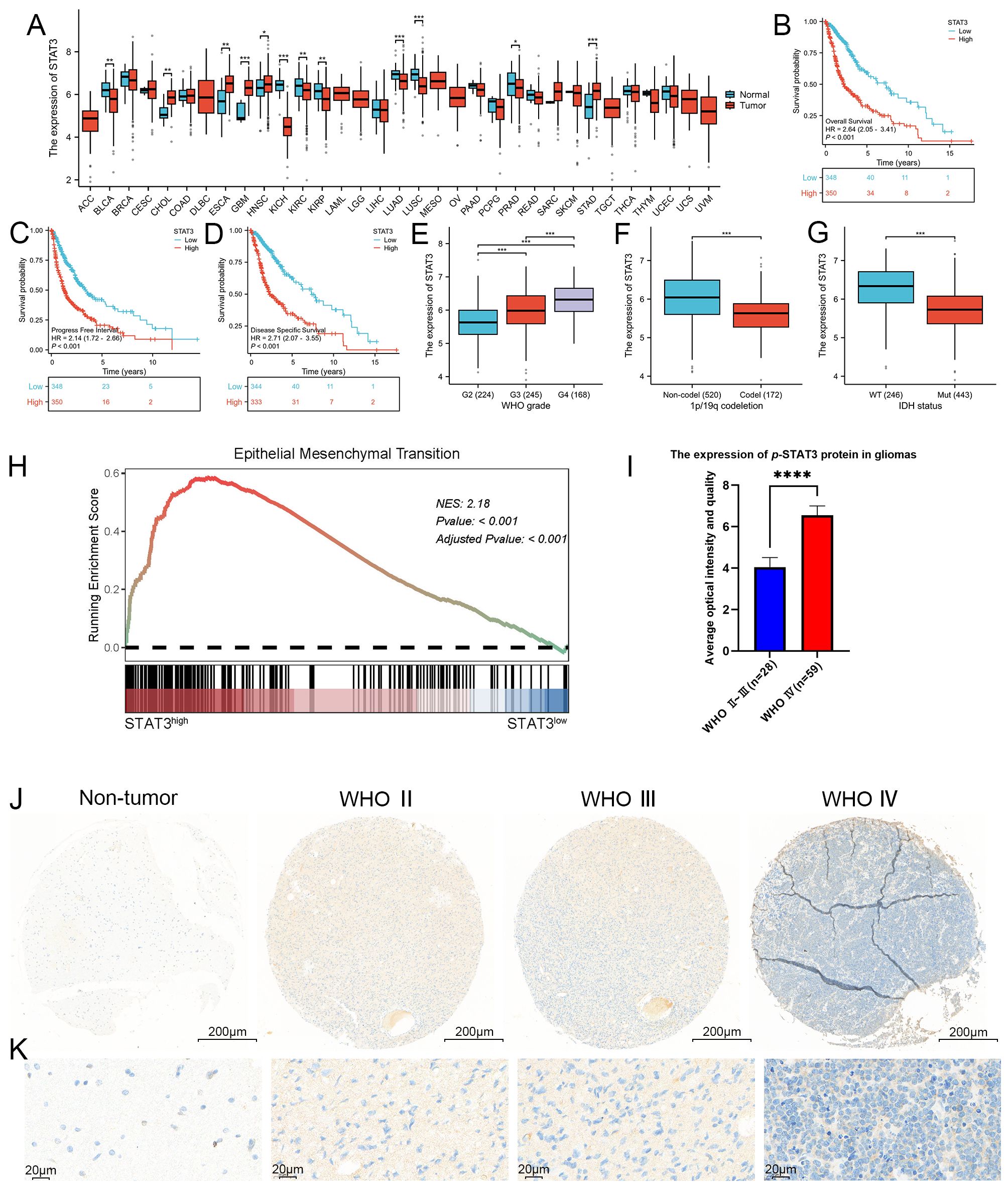 A series of data visualizations analyzing STAT3 expression in tumors. Panel A shows box plots comparing STAT3 expression in various cancer types. Panel B displays an overall survival curve related to STAT3. Panels C and D present progression-free and disease-specific survival curves. Panels E, F, and G show box plots of STAT3 expression across WHO grades and IDH status. Panel H features a graph of epithelial-mesenchymal transition enrichment. Panel I is a bar chart of p-STAT3 protein expression in gliomas. Panels J and K depict histological images of tumors with different WHO grades, showing variations in staining.
