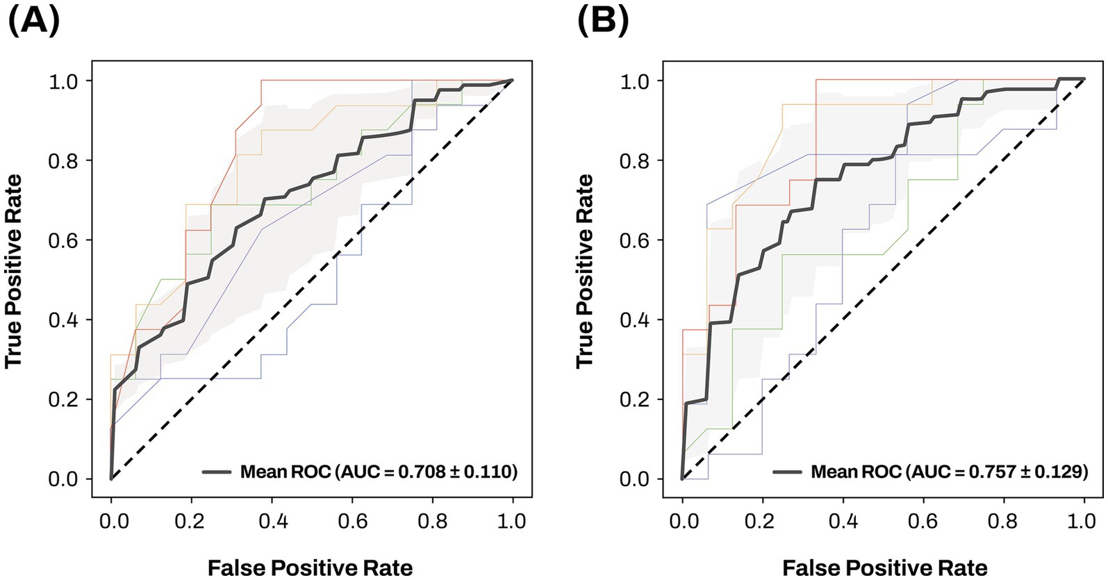 Two ROC curves compare the performance of models. Chart (A) shows a mean ROC with an area under the curve (AUC) of 0.708 plus/minus 0.110. Chart (B) shows a mean ROC with an AUC of 0.757 plus/minus 0.129. Both charts plot true positive rate against false positive rate, with a diagonal reference line.