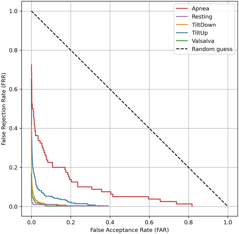 Receiver Operating Characteristic (ROC) curve showing various states labeled Apnea, Resting, TiltDown, TiltUp, and Valsalva, with False Rejection Rate on the y-axis and False Acceptance Rate on the x-axis. A dashed line indicates random guess. The Apnea curve is distinctively higher, while others maintain lower rates.