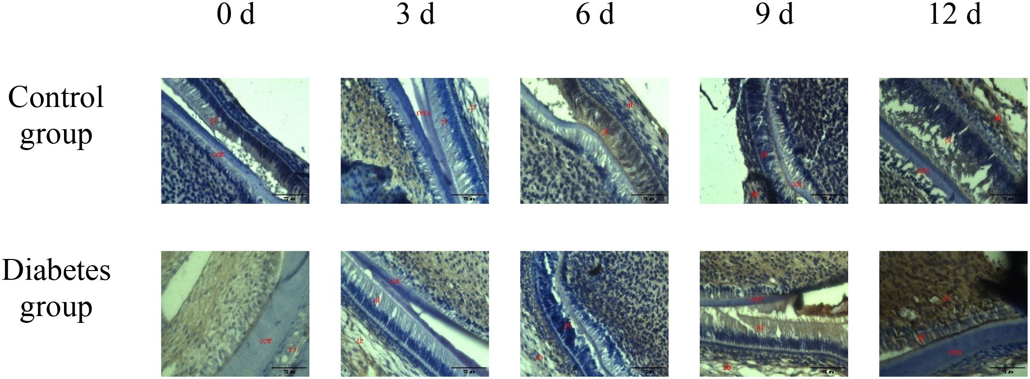 Microscopic images comparing periapical tissue between control and diabetes groups over time. Top row: control group at 0, 3, 6, 9, and 12 days. Bottom row: diabetes group at the same intervals. Each set indicates changes in tissue structure with time and condition.