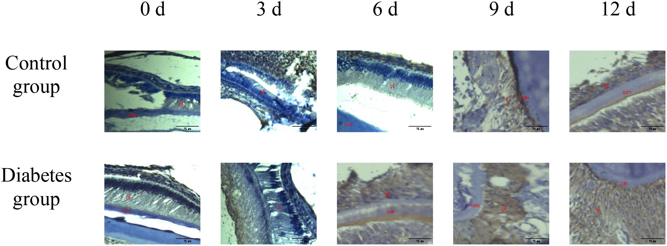 Microscopic images show tissue samples from control and diabetes groups at different time points: 0, 3, 6, 9, and 12 days. Each row compares the progression of changes in the tissues, highlighting differences between the two groups over time. Labels such as 'pl', 'ab', and 'cem' are present.