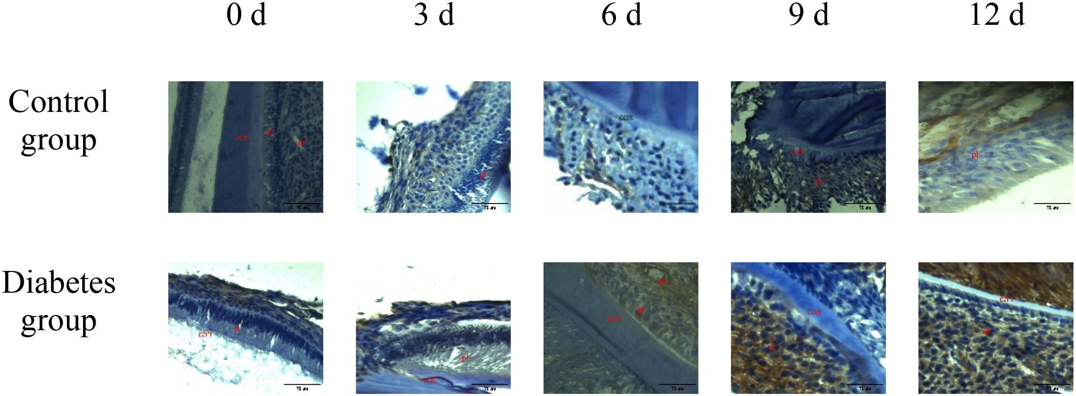 Histological images showing tissue samples from control and diabetes groups over time: 0, 3, 6, 9, and 12 days. Each row compares the progression of changes in the tissues, highlighting differences between the two groups over time. Labels and scales are present for reference.