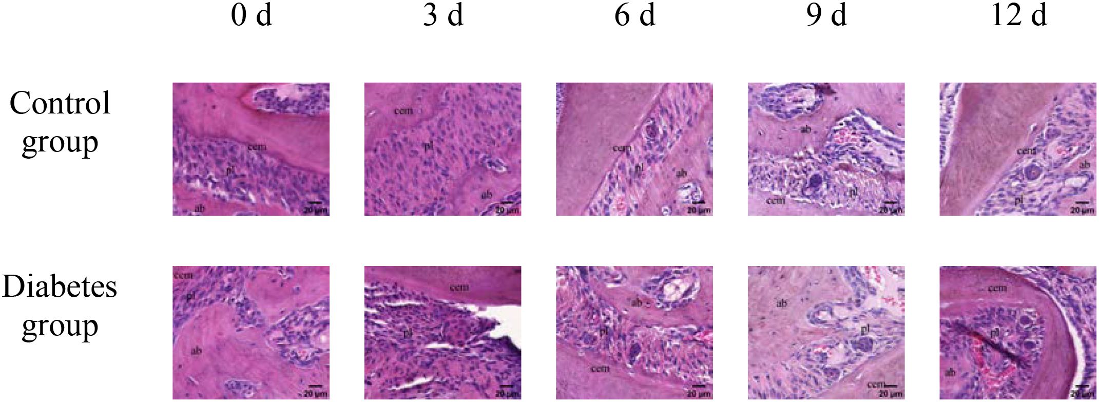 Histological images showing tissue samples from control and diabetes groups at 0, 3, 6, 9, and 12 days. Each row represents a group, with specific cellular structures and changes labeled. Staining highlights differences over time.