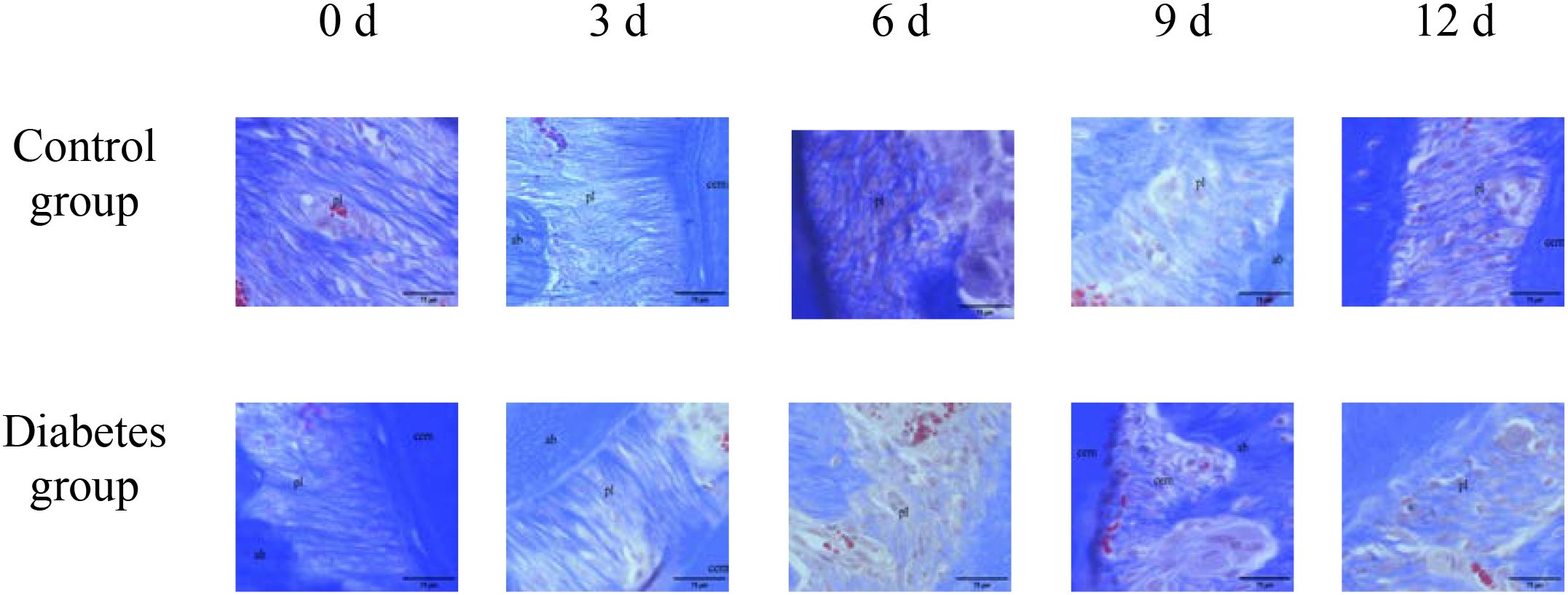 Microscopic images comparing control and diabetes groups over five time intervals: 0, 3, 6, 9, and 12 days. Both groups show tissue samples with variations in structure and color, indicating different progressions of the condition over time.