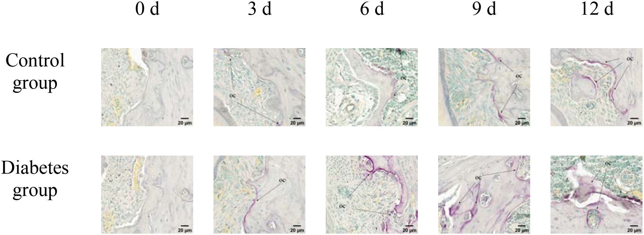 Microscopic images show tissue samples from control and diabetes groups at intervals of zero, three, six, nine, and twelve days. Each sample varies in cellular structure and density. Scale bars indicate twenty micrometers.