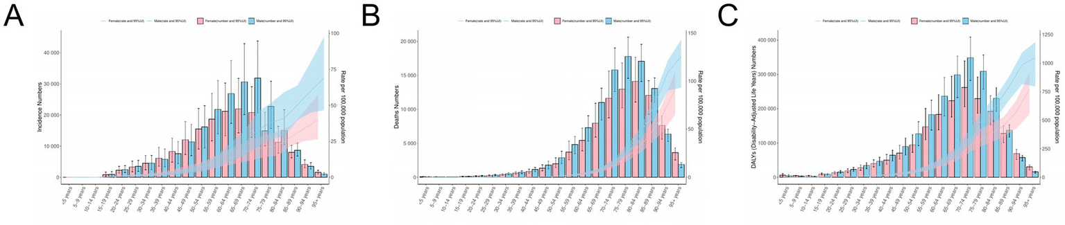 Three bar charts labeled A, B, and C show data segmented by age groups and gender. Chart A displays incidence numbers, Chart B presents death numbers, and Chart C illustrates disability-adjusted life years (DALYs). Each chart uses pink for females and blue for males. Error bars and shaded areas indicate a ninety-five percent uncertainty interval (UI). Data shows higher figures in older age groups across all charts.