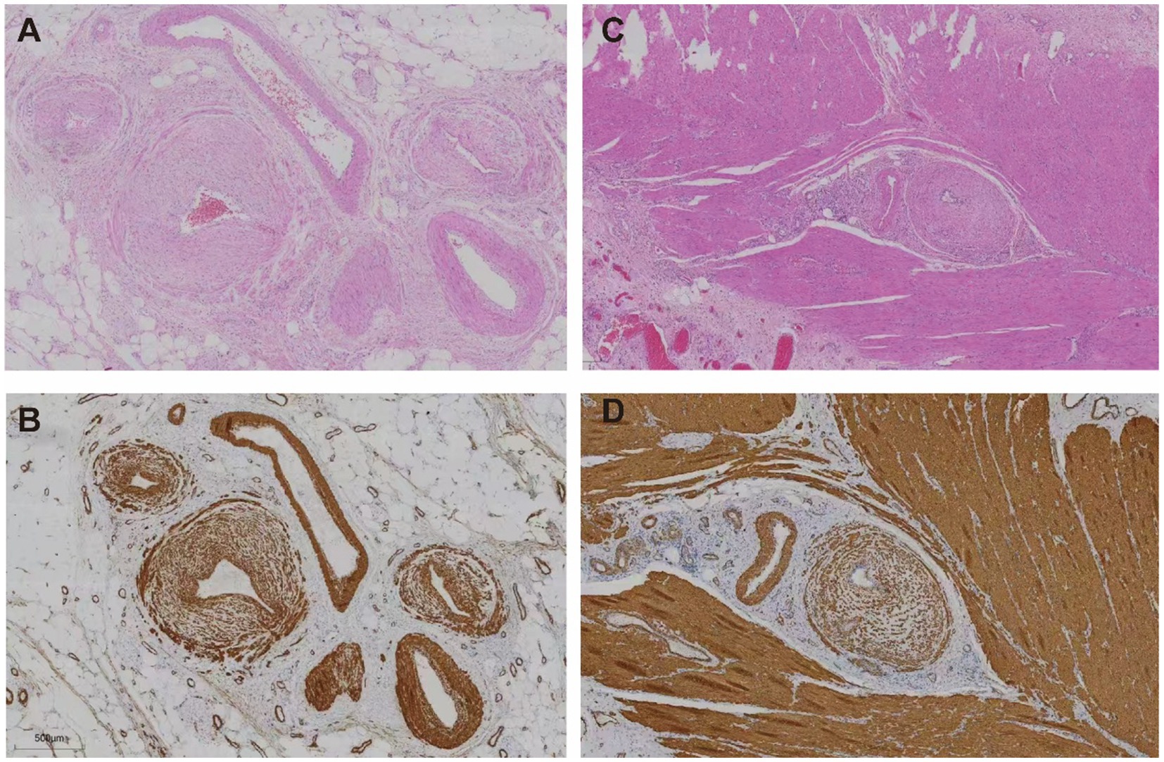 Four histological images labeled A, B, C, and D. Image A shows a tissue sample stained with hematoxylin and eosin, featuring circular structures. Image B displays a similar sample with DAB chromogen highlighting brown-stained areas. Image C presents a tissue section with elongated structures using hematoxylin and eosin. Image D shows the counterpart with DAB chromogen emphasizing brown areas, indicating specific protein expression or cellular components.