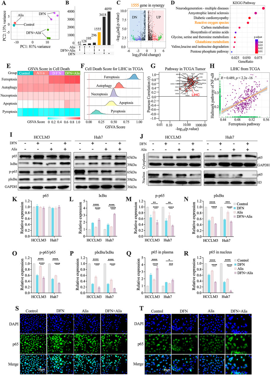 A collection of scientific data visualizations and experimental results related to cell death and gene expression studies. The figures include a principal component analysis plot (A), a bar graph depicting differentially expressed genes (B), a volcano plot illustrating gene expression changes (C), KEGG pathway analysis (D), and GSVA scores for various cell death types (E,F). Additional data show pathway correlations in tumors (G) and ferroptosis analysis (H). Western blot images (I,J) and corresponding bar graphs (K-R) reveal protein expression levels in different conditions. Confocal microscopy images (S,T) display cellular localization of proteins with DAPI and p65 staining.