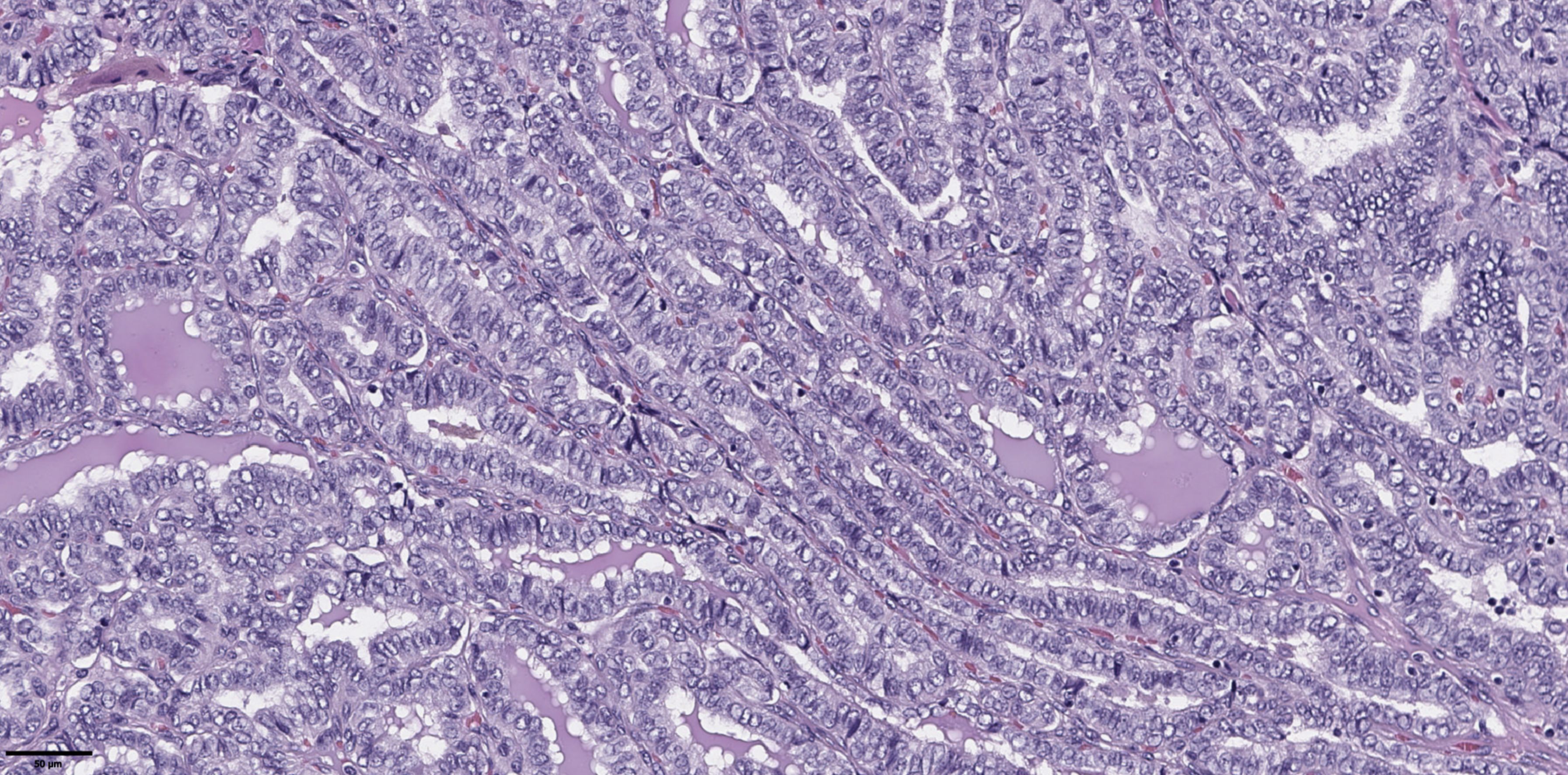 Microscopic image showing a close-up of glandular tissue, likely from a biological specimen. The tissue displays a complex arrangement of tightly packed cells with visible nuclei, stained in shades of purple and pink.